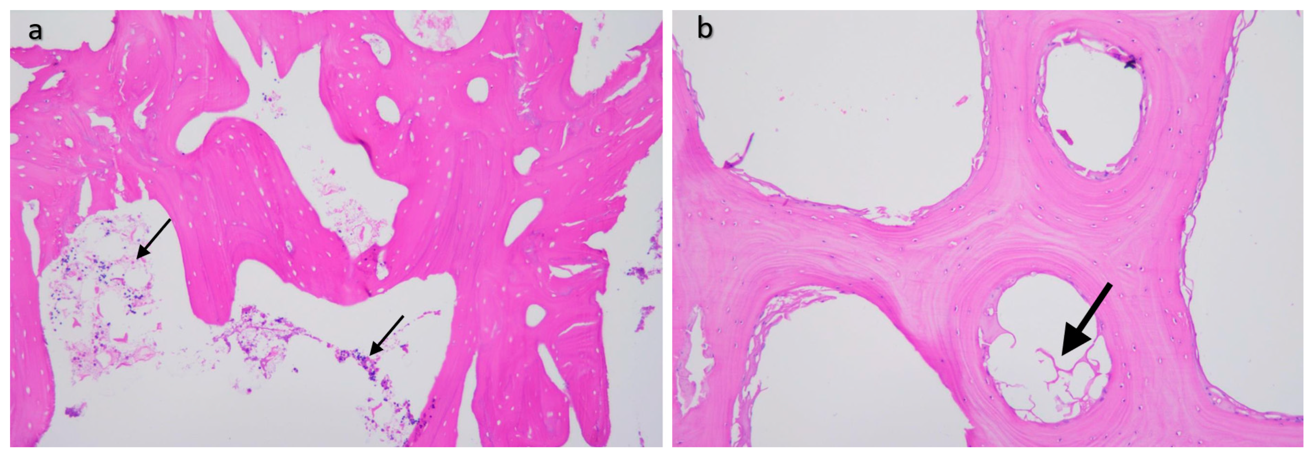 Materials 16 03861 g011