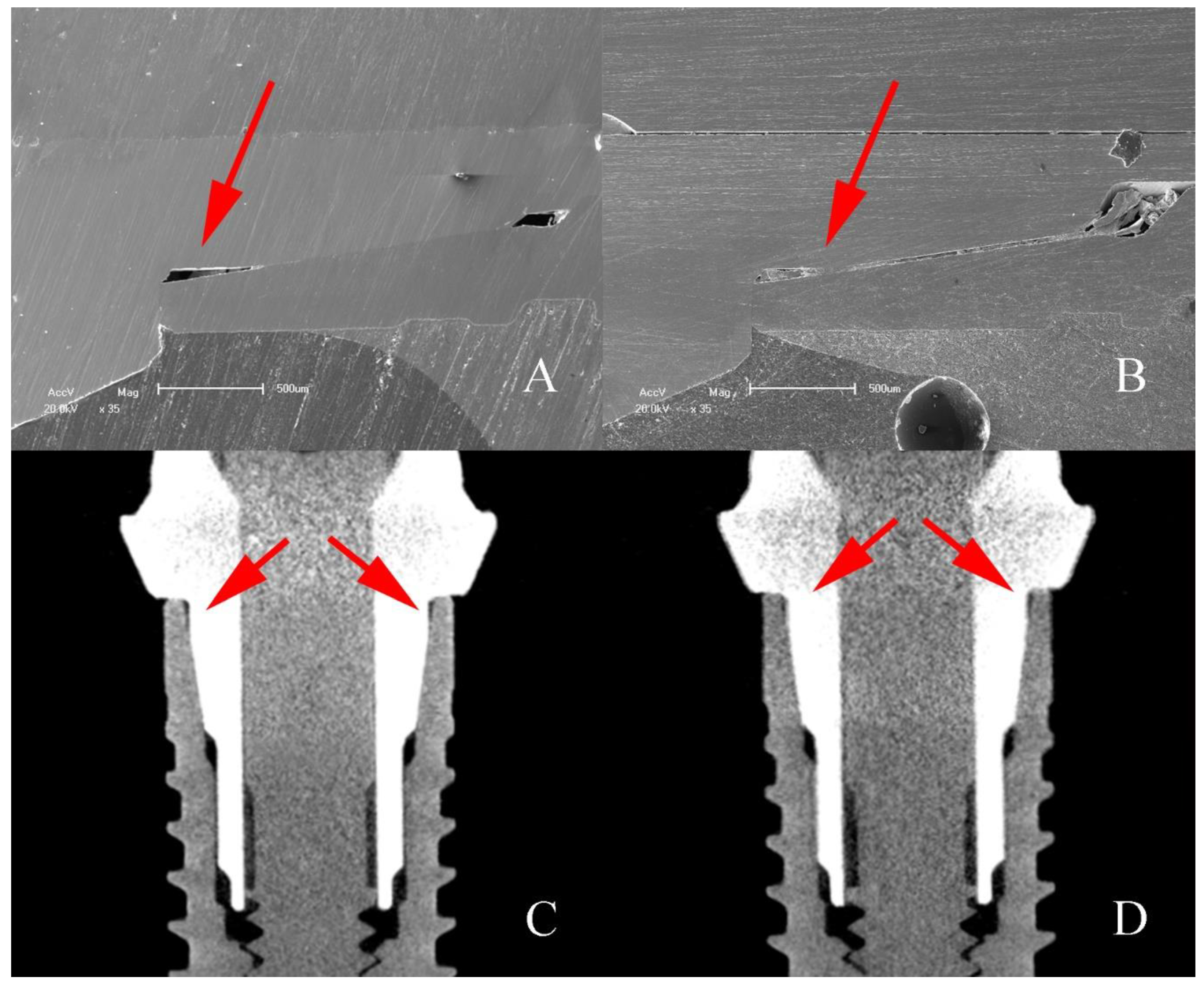 Materials 16 03904 g011