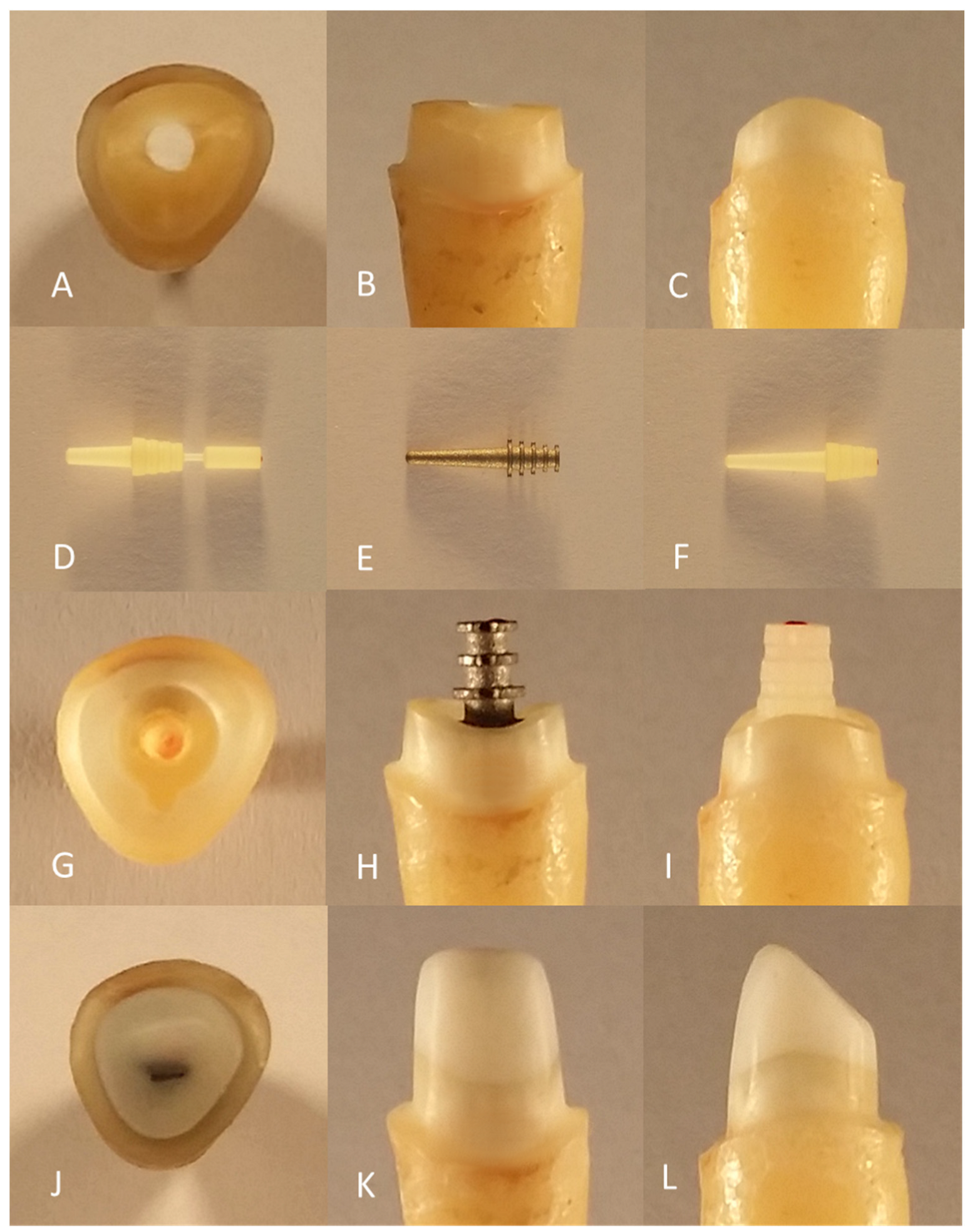 Materials 16 03985 g001 Materials 16 03985 g001