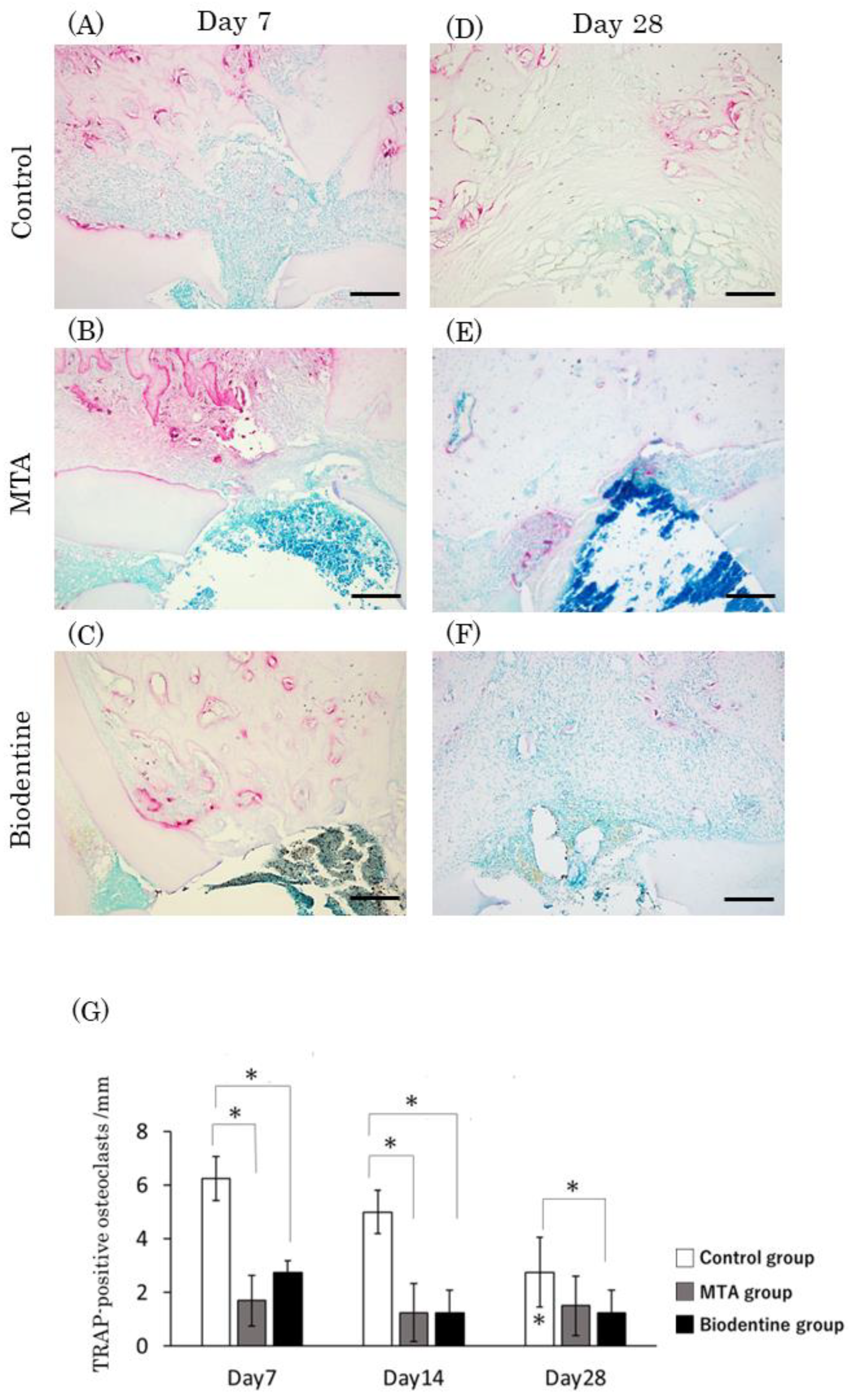 Materials 16 04451 g012