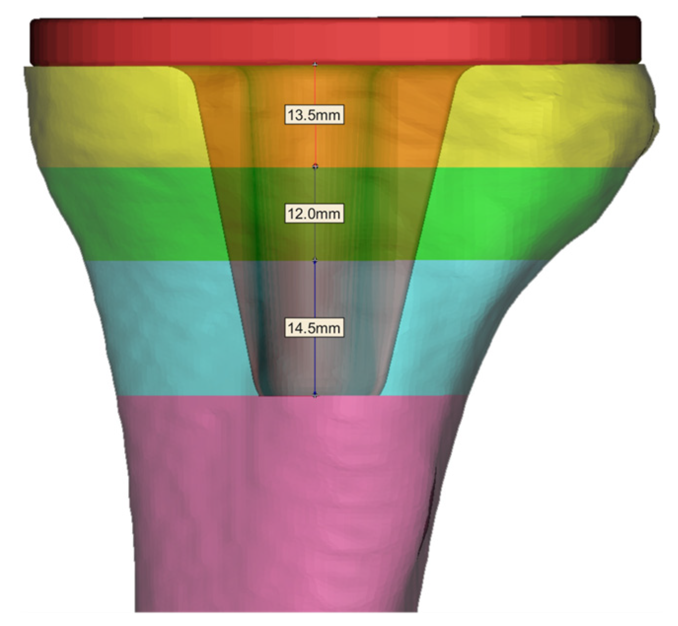 Materials 16 04720 g004