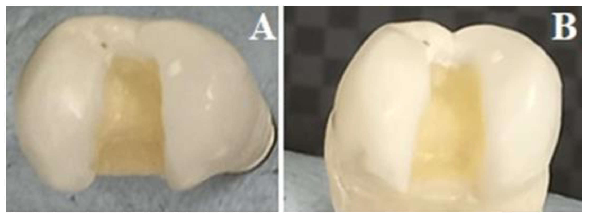 Materials 16 04830 g002