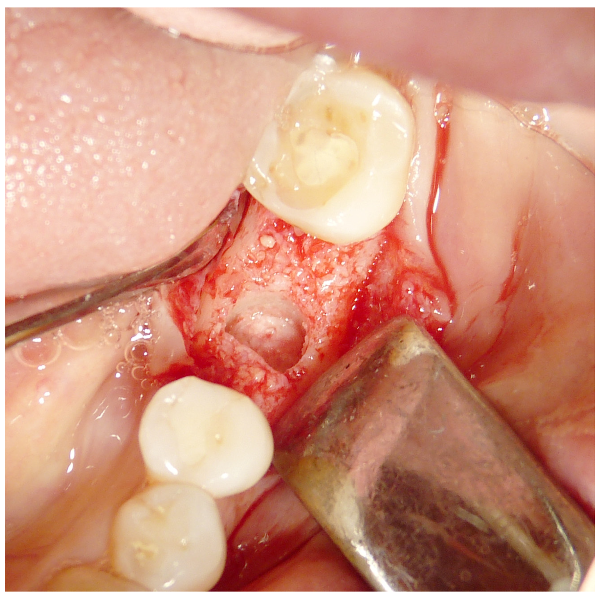 Materials 16 04945 g002 Materials 16 04945 g002