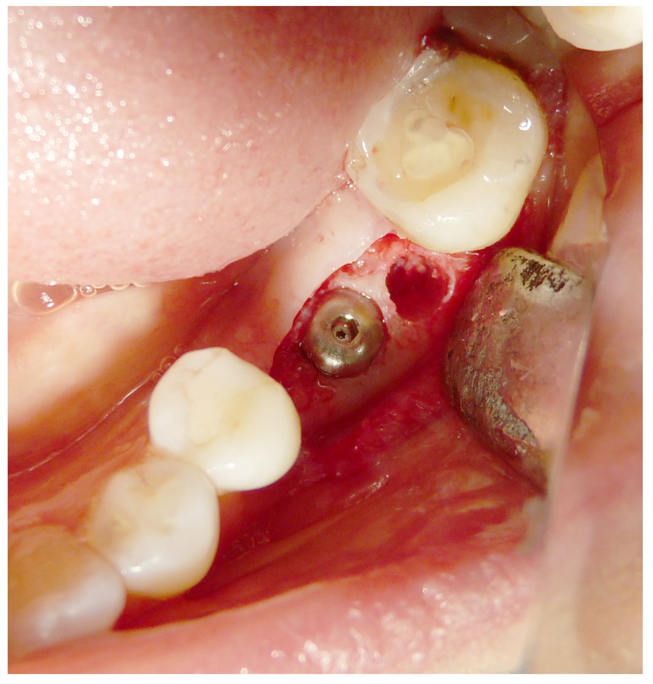 Materials 16 04945 g004 Materials 16 04945 g004