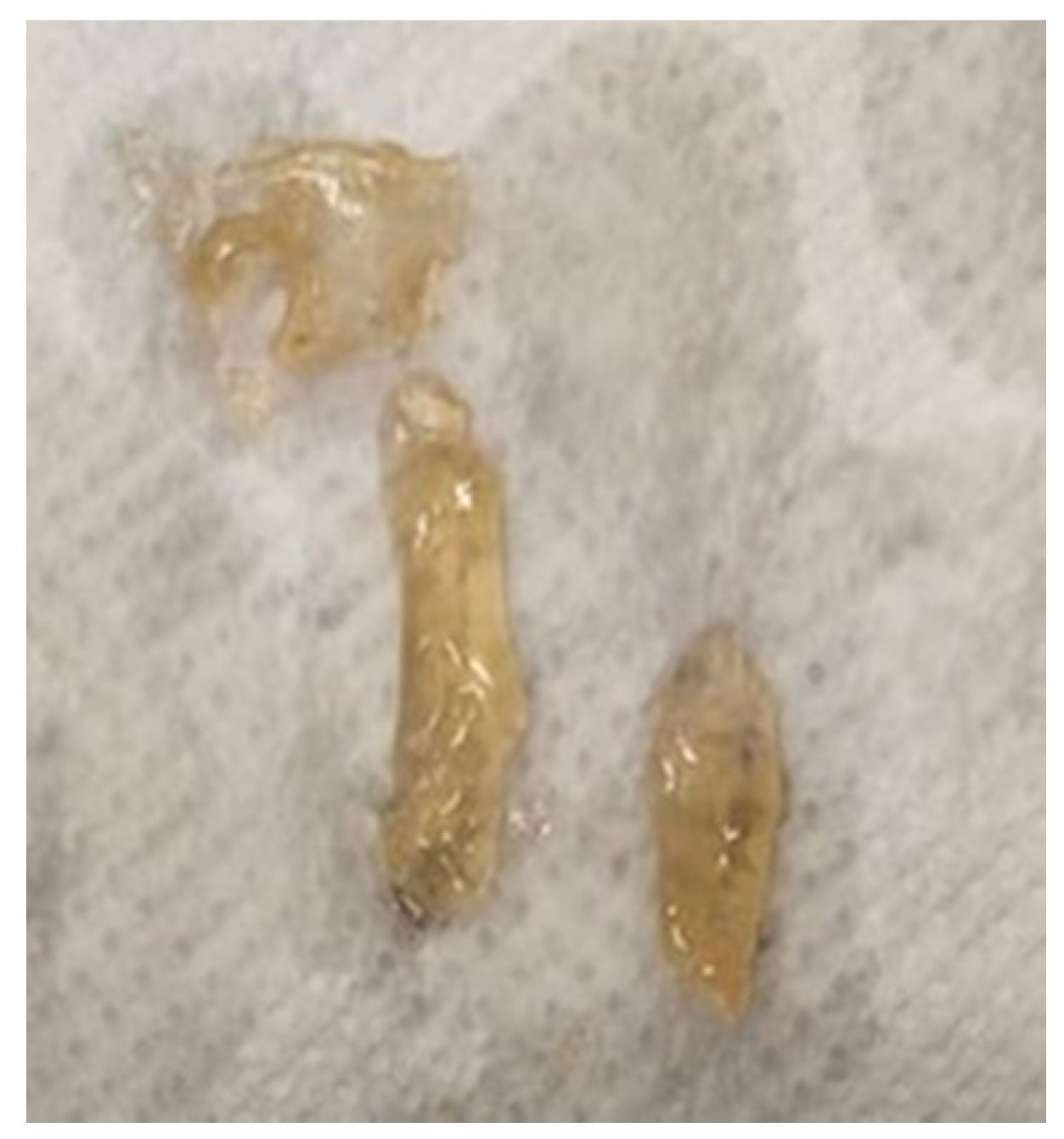 Materials 16 05038 g009