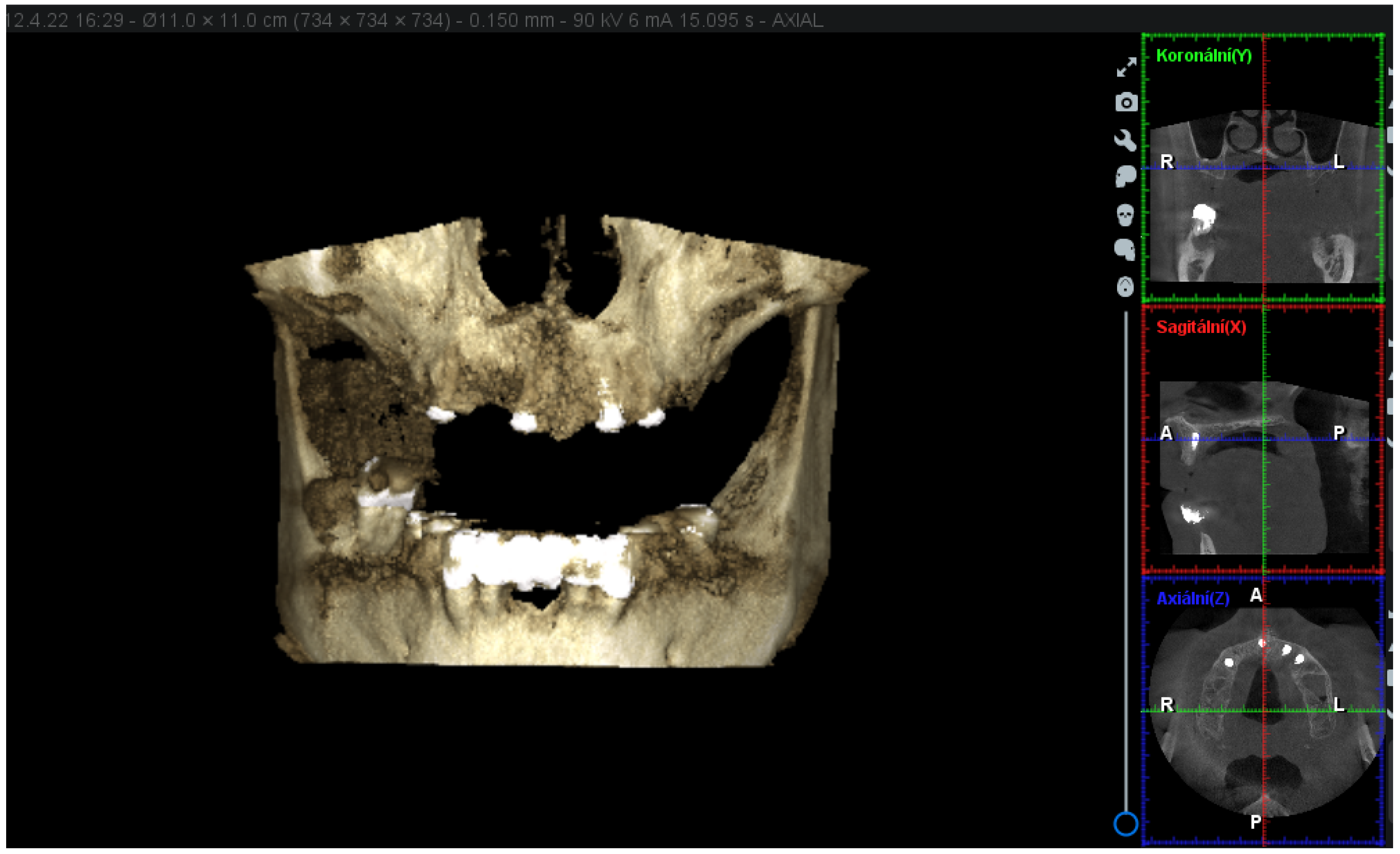 Materials 16 05248 g003