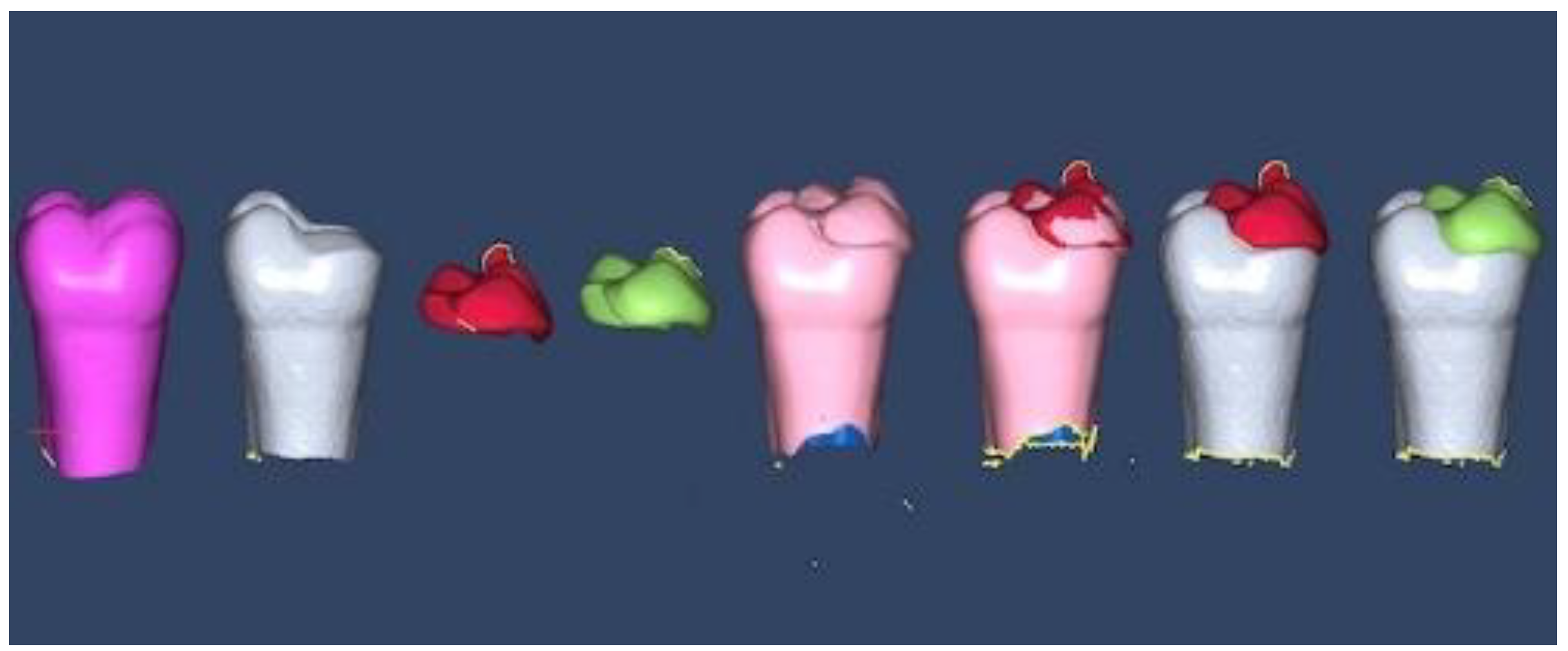 Materials 16 06962 g006