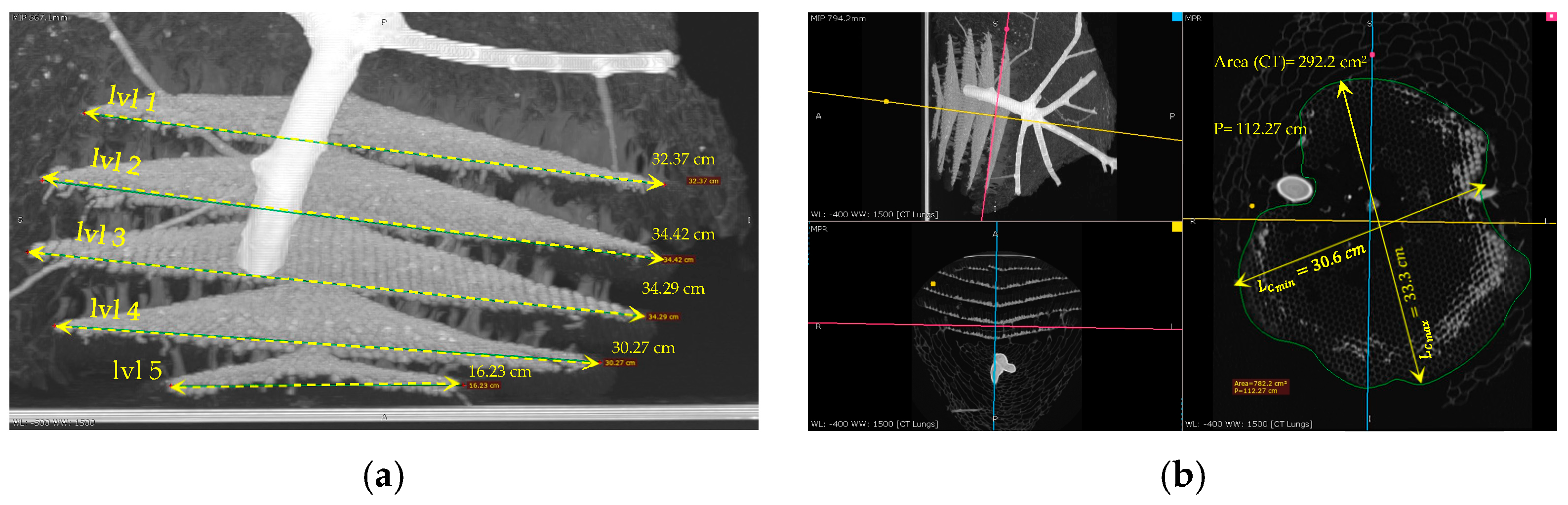 Materials 16 07027 g011a