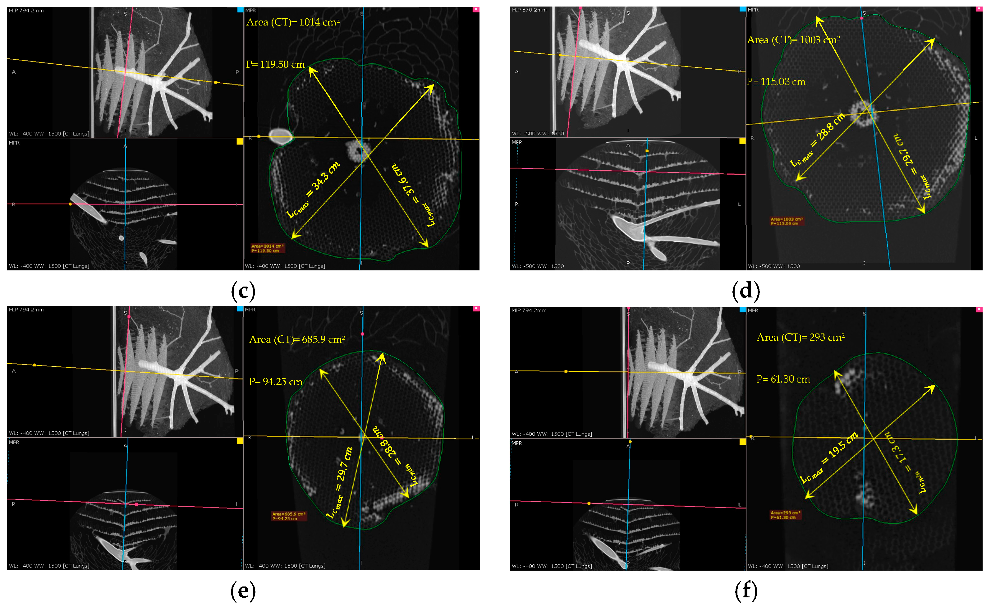 Materials 16 07027 g011b