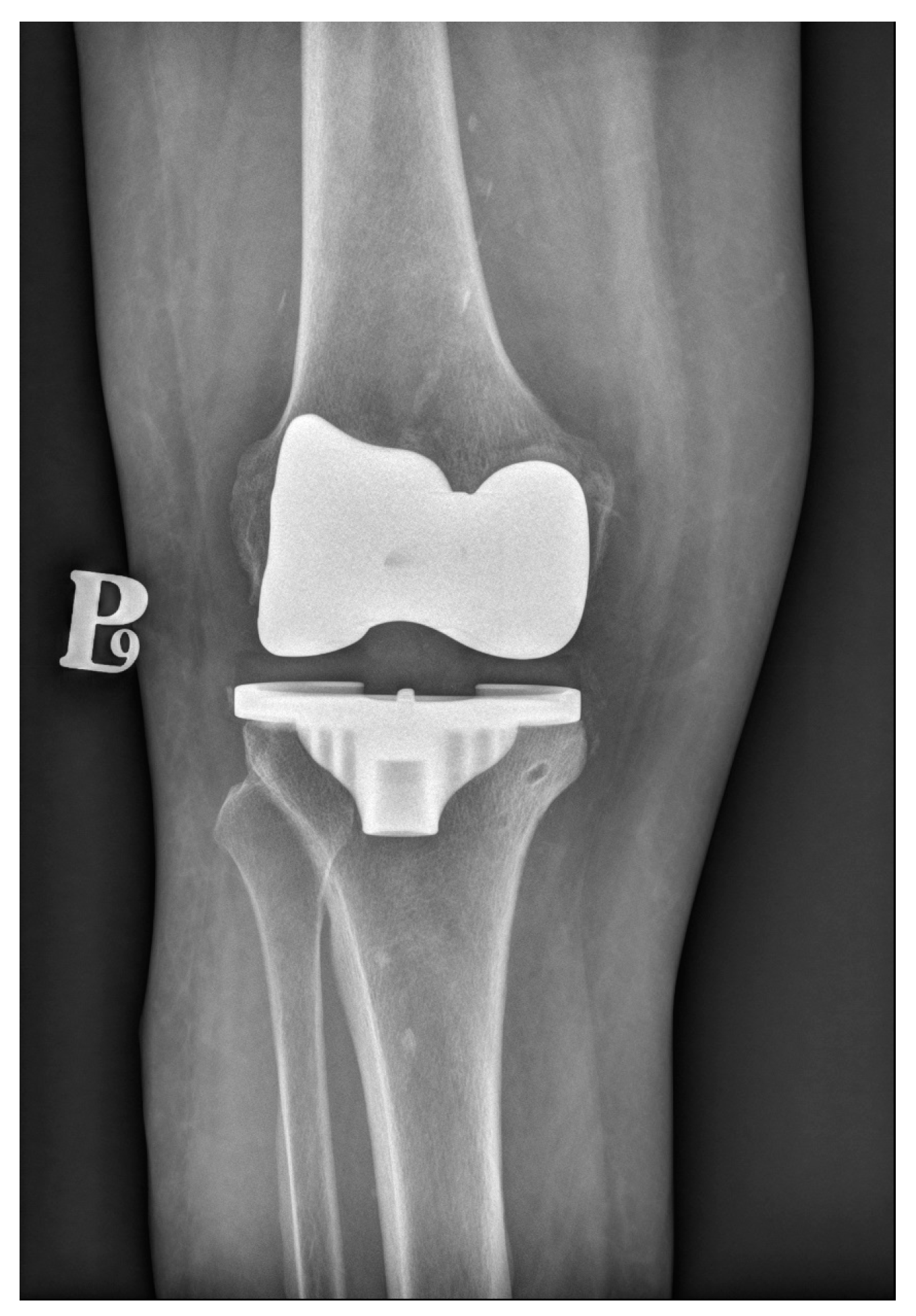 Materials 17 01136 g002