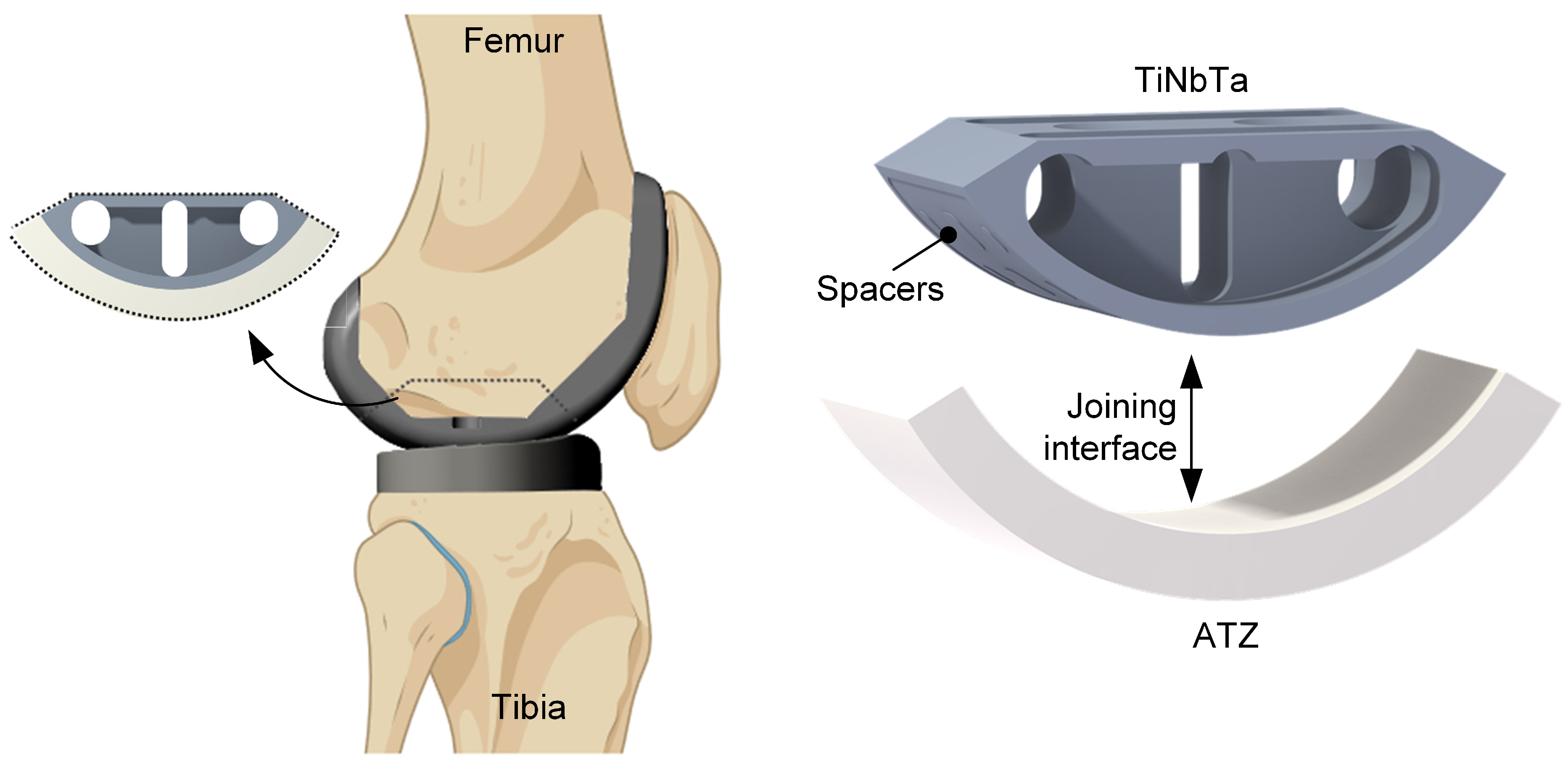 Materials 17 01838 g002