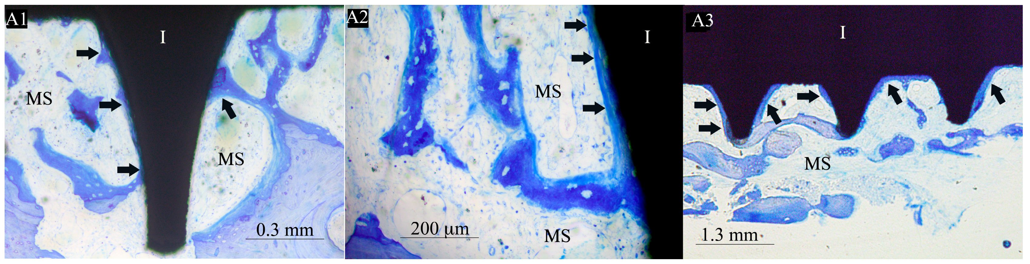 Materials 17 02331 g004