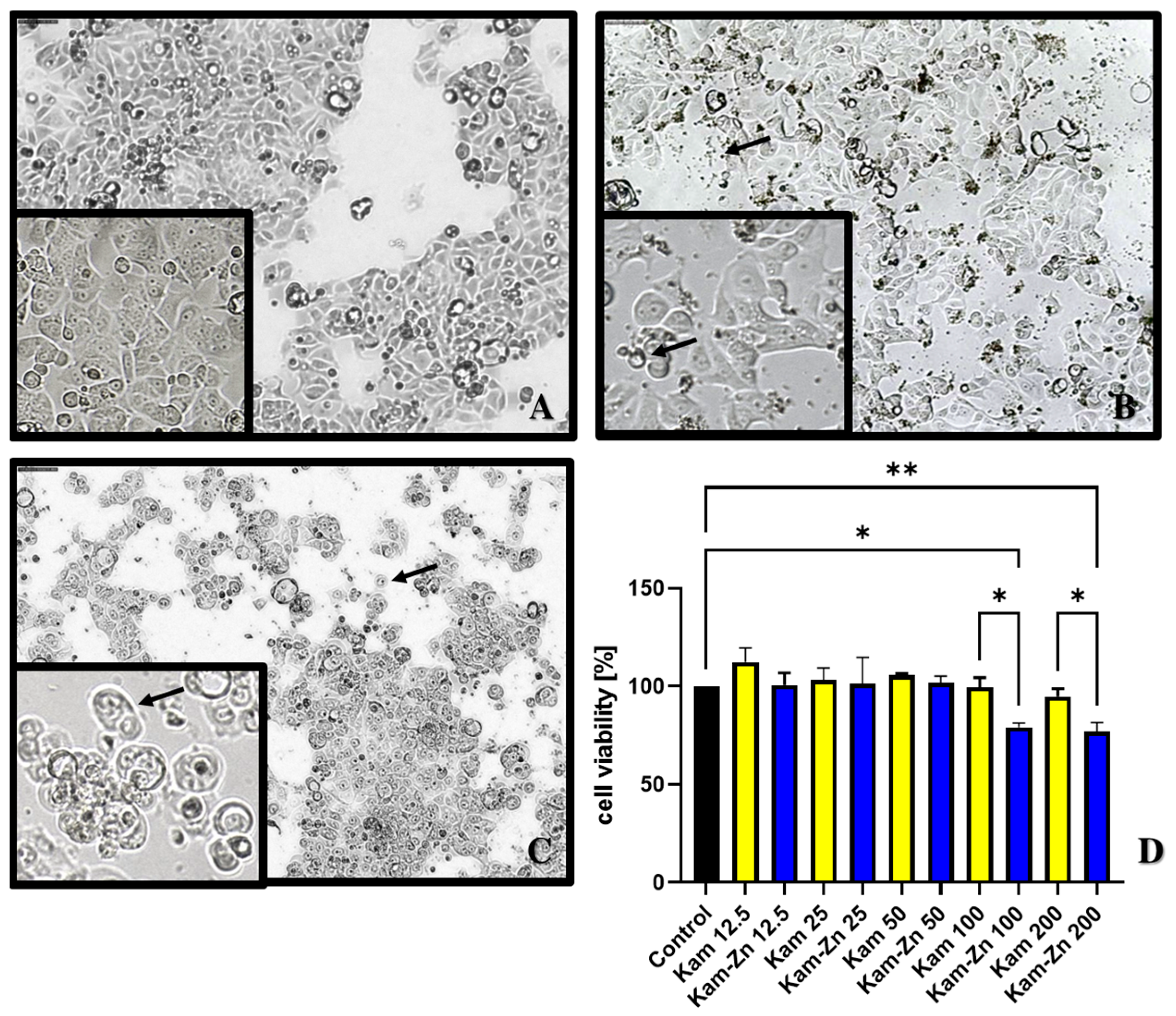 Materials 17 02526 g007