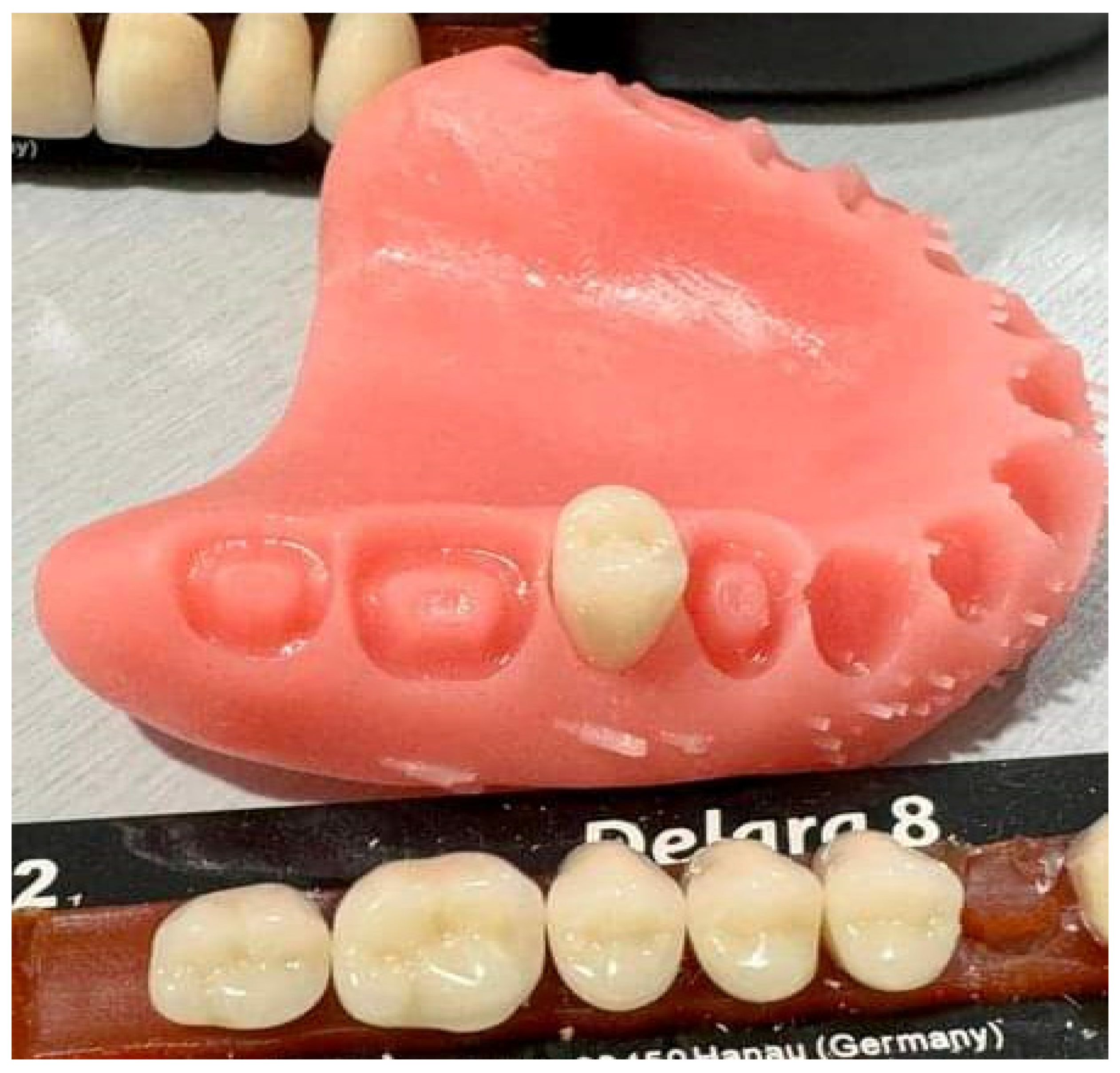 Materials 17 03138 g002