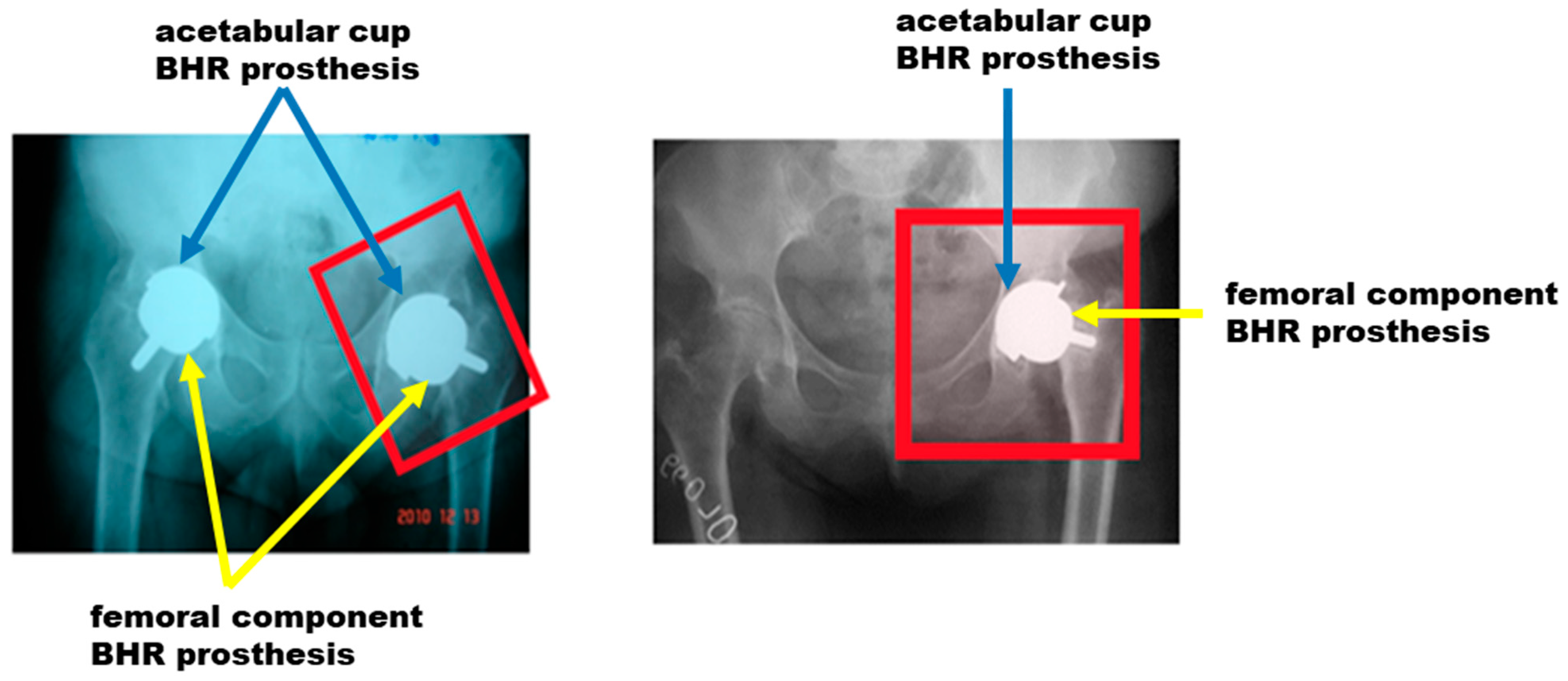 Materials 17 03965 g007