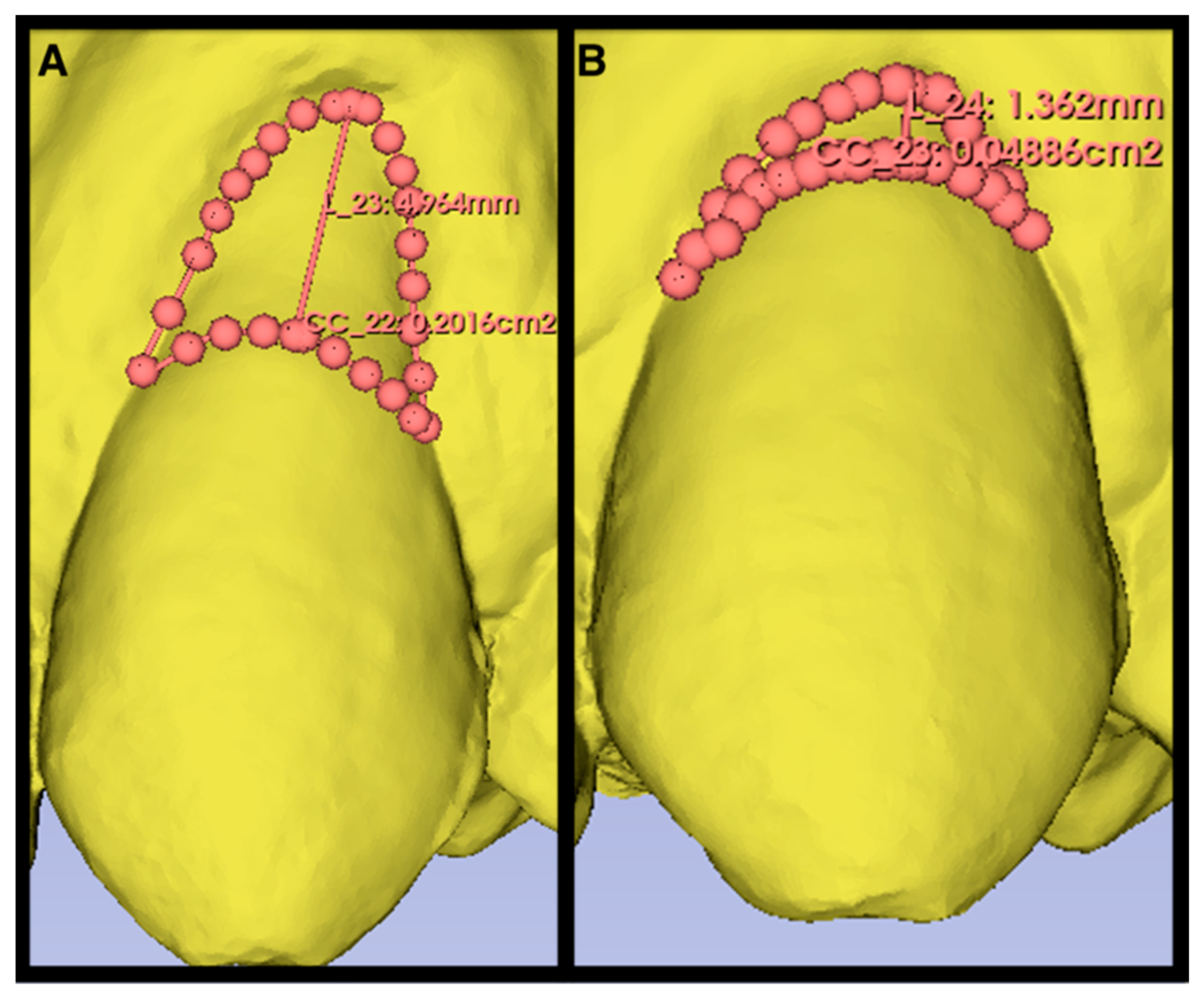 Materials 17 03985 g003 Materials 17 03985 g003