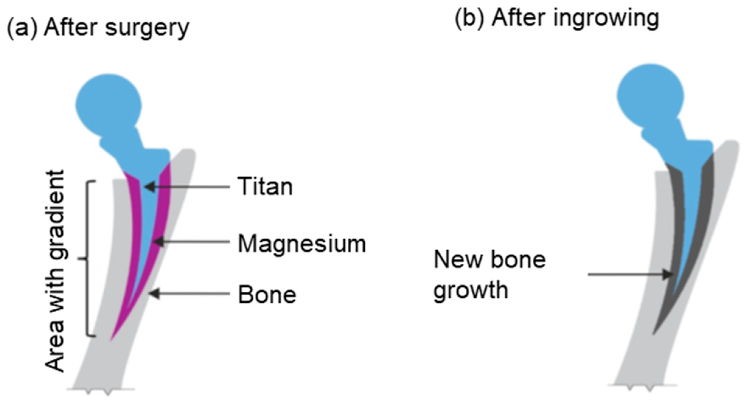 Materials 17 04667 g002