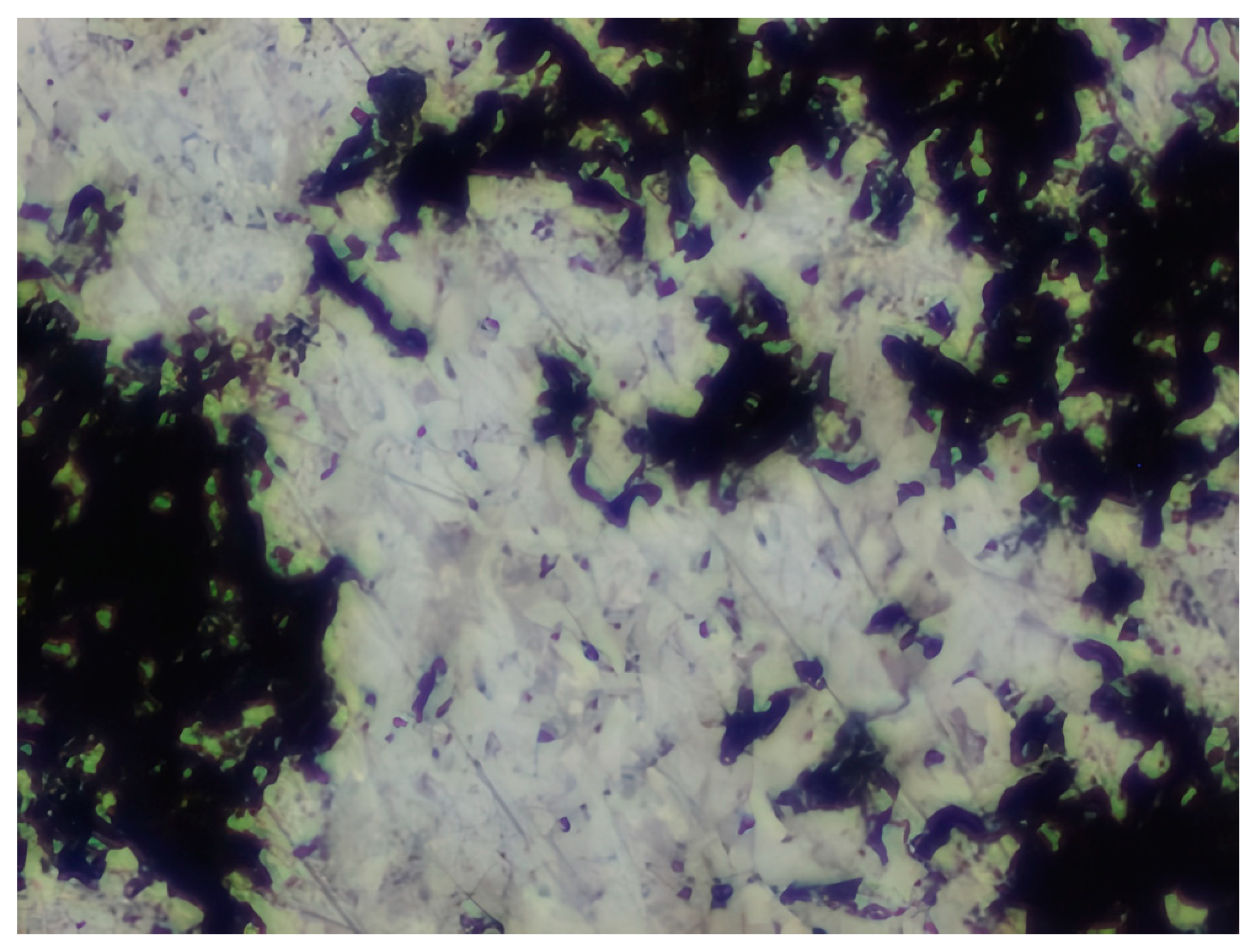 Materials 17 04728 i005