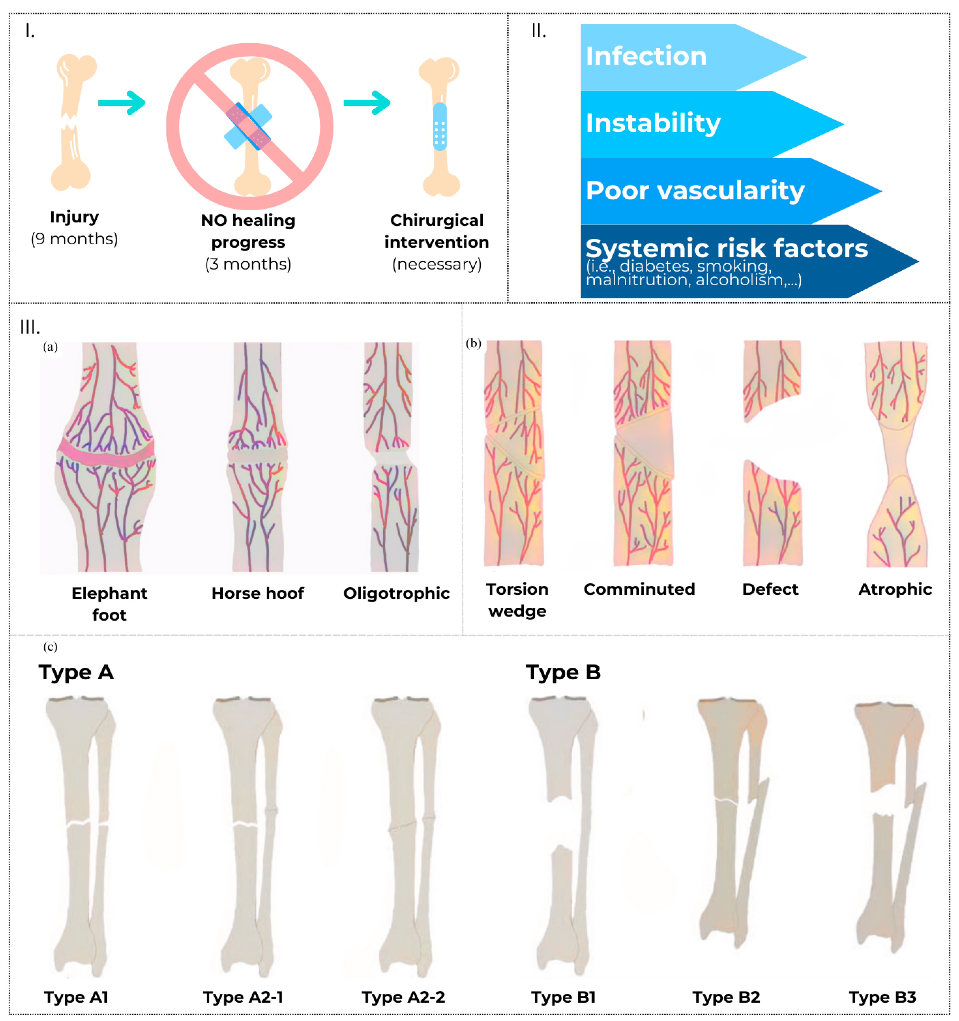 Materials 17 05305 g001