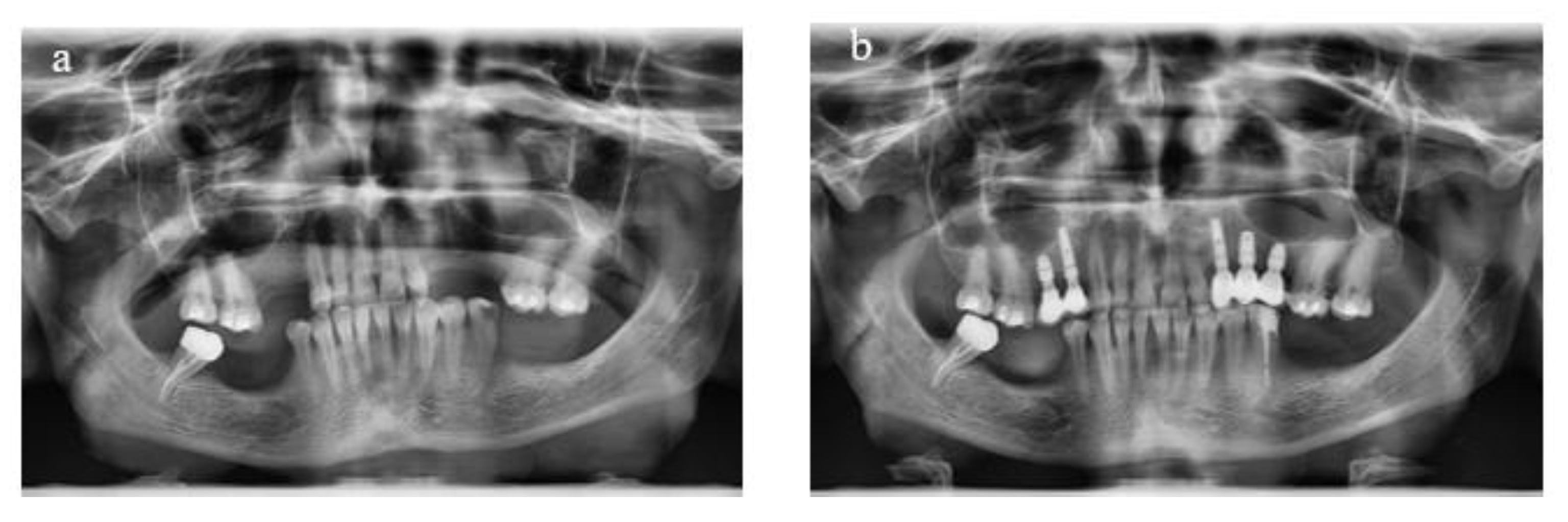 Materials 18 00183 g001