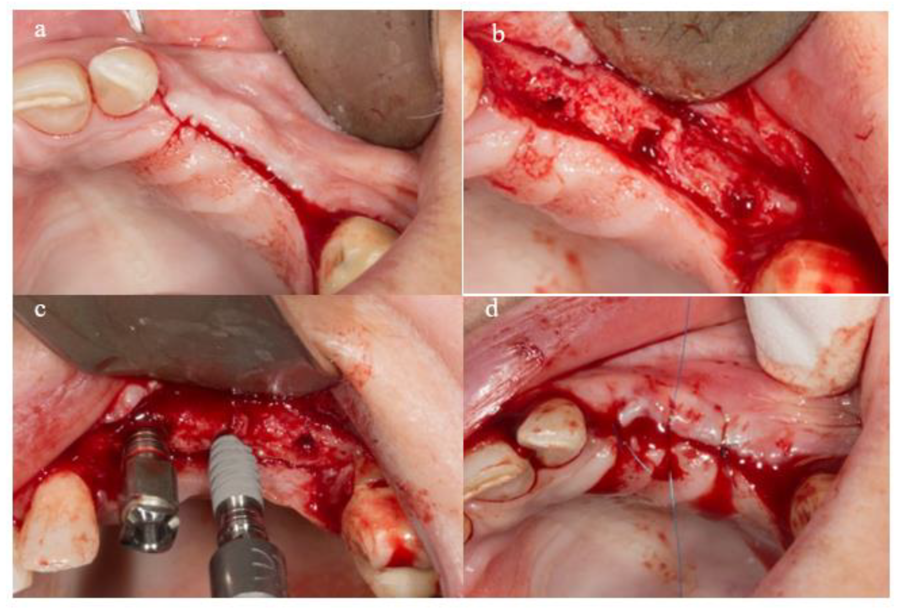 Materials 18 00183 g002