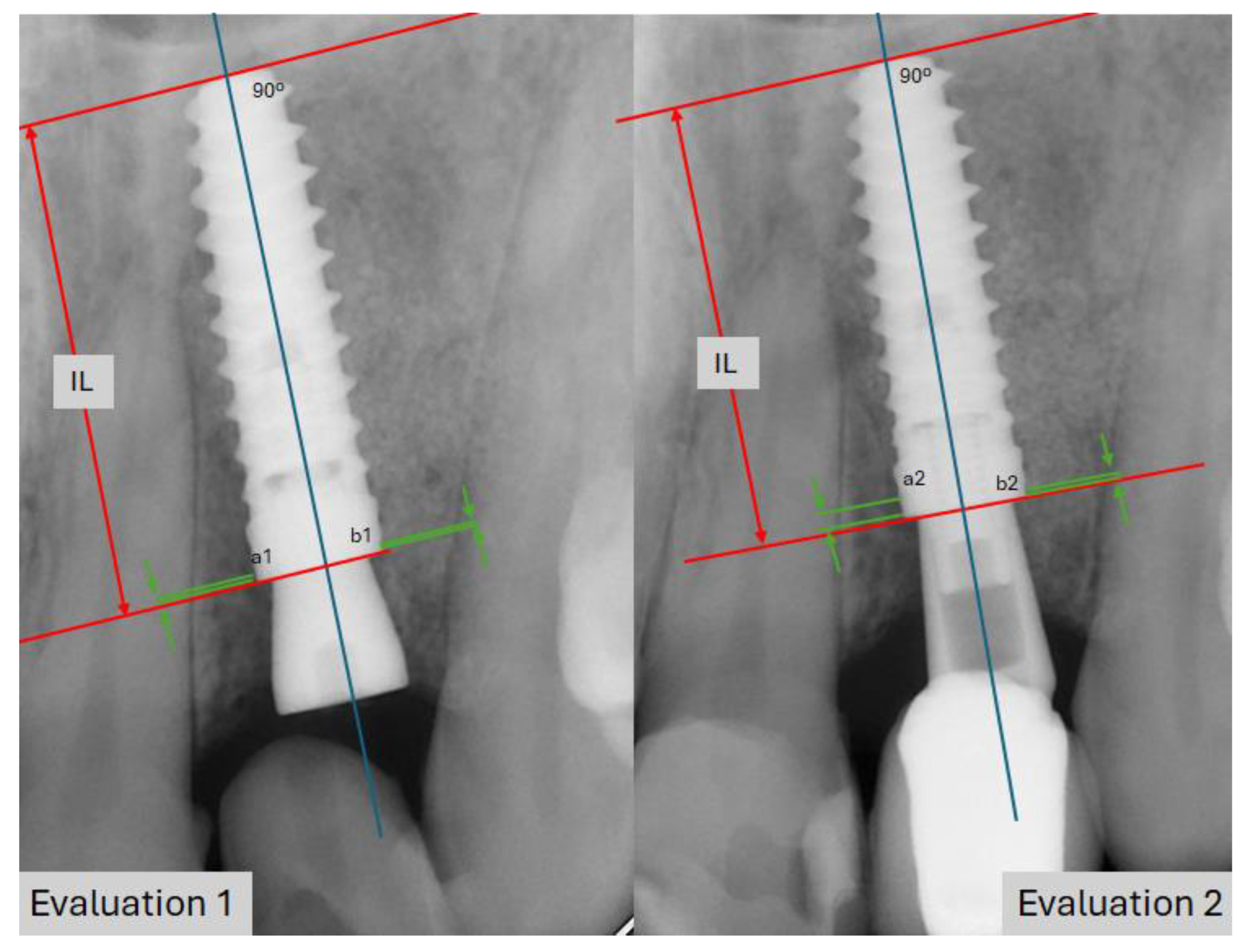 Materials 18 00183 g004