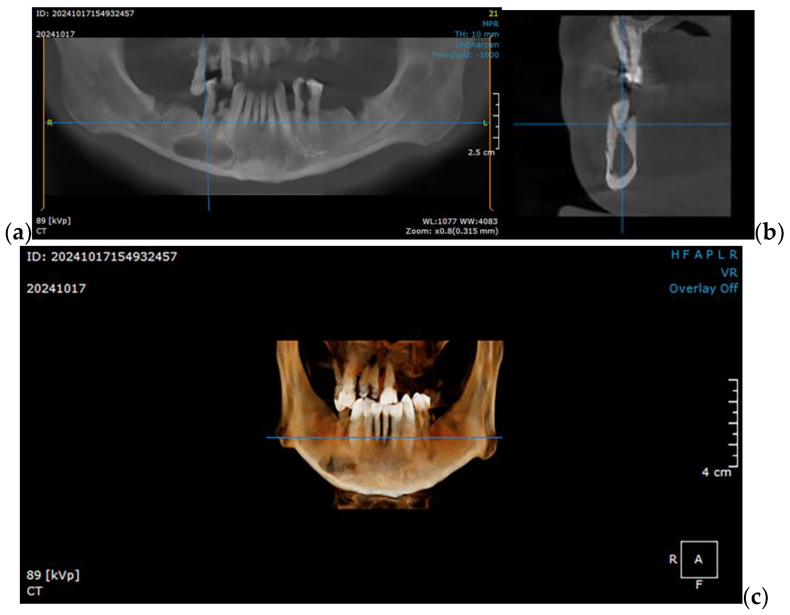 Materials 18 00314 g001