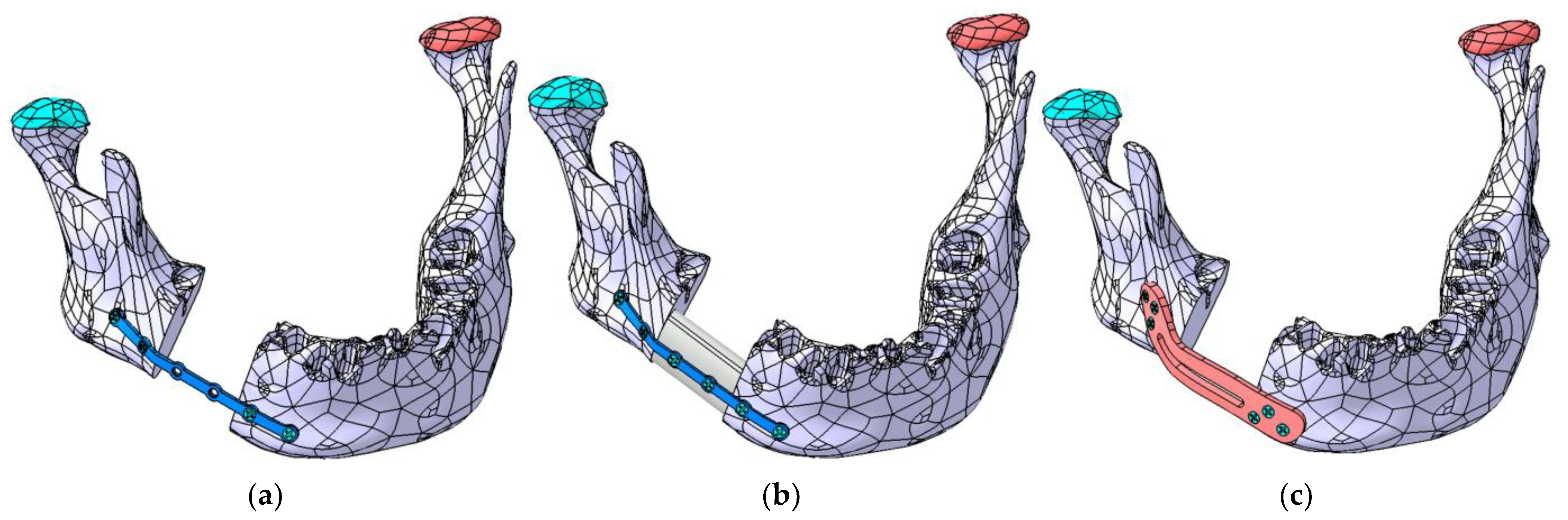 Materials 18 00314 g011