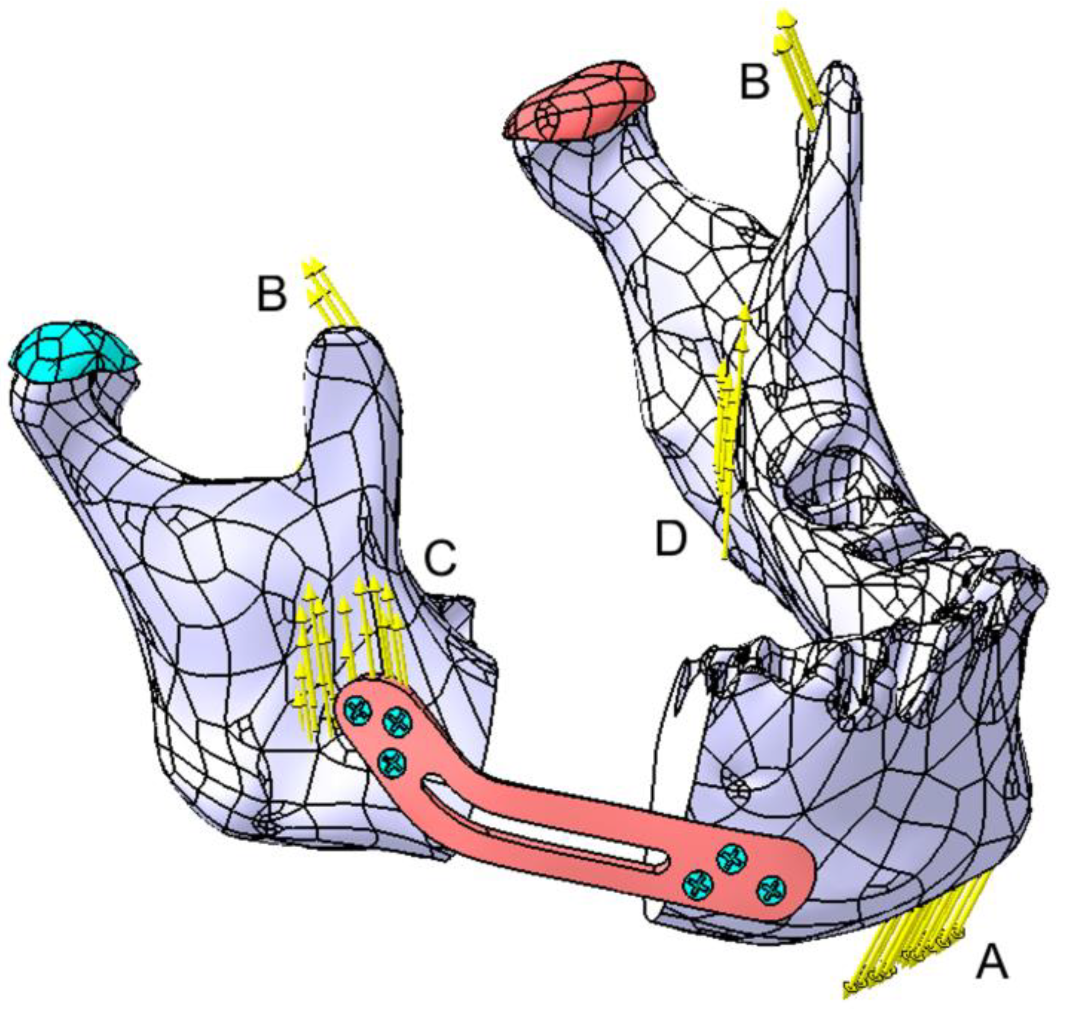 Materials 18 00314 g012