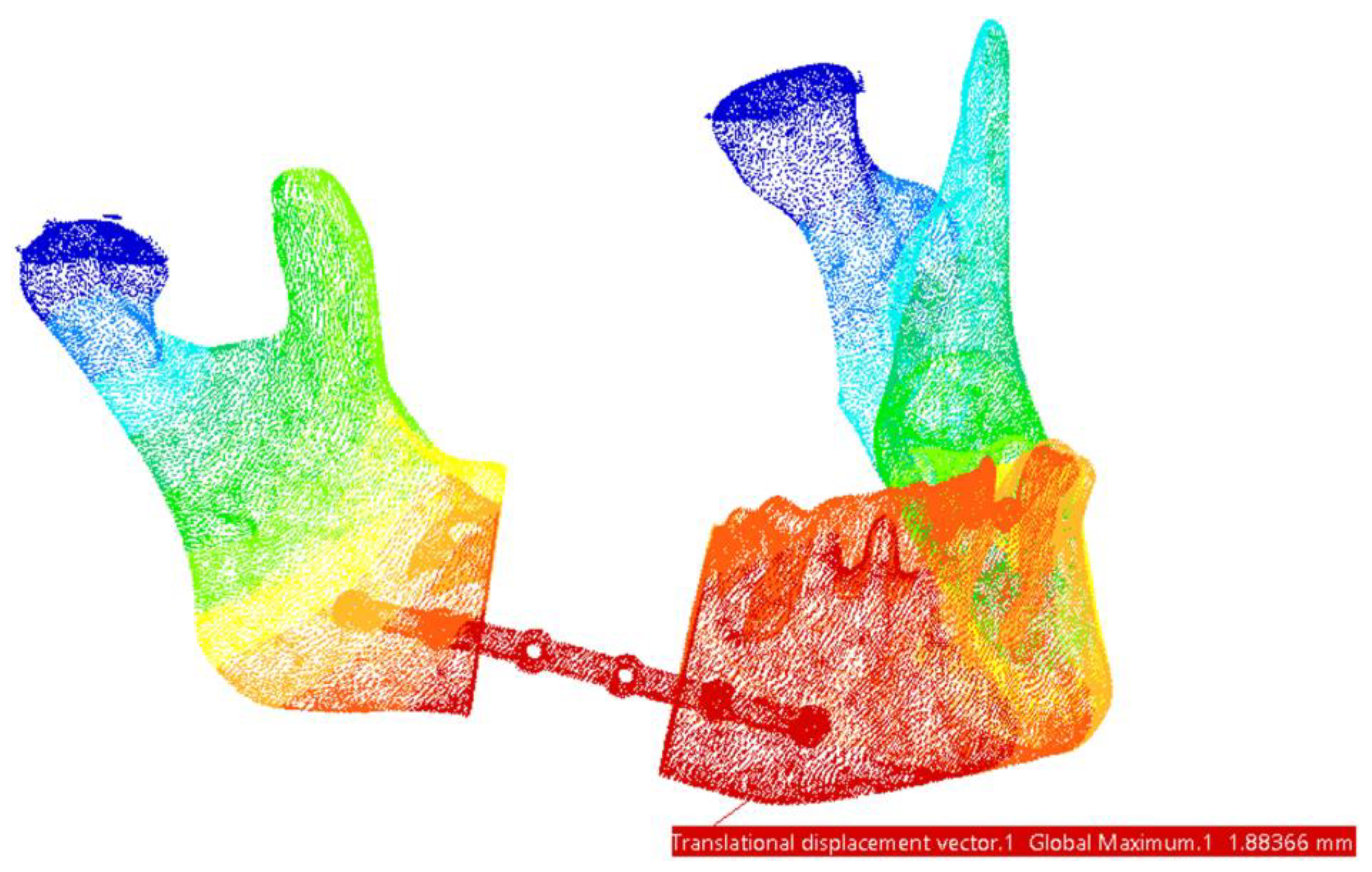 Materials 18 00314 g015