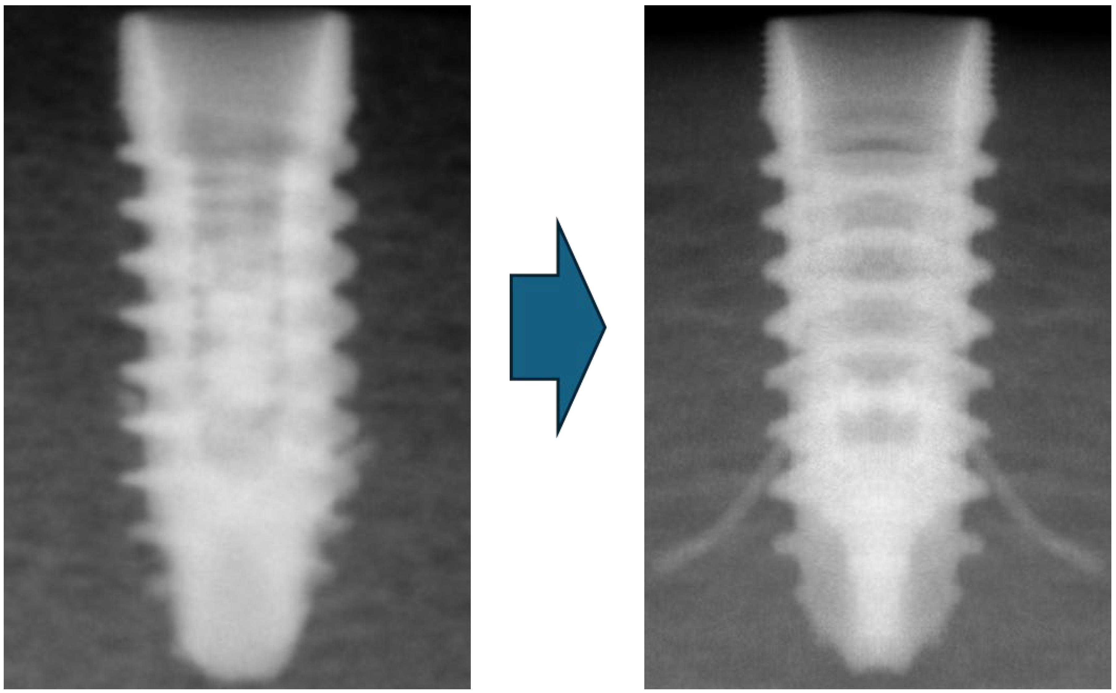 Materials 18 00700 g004