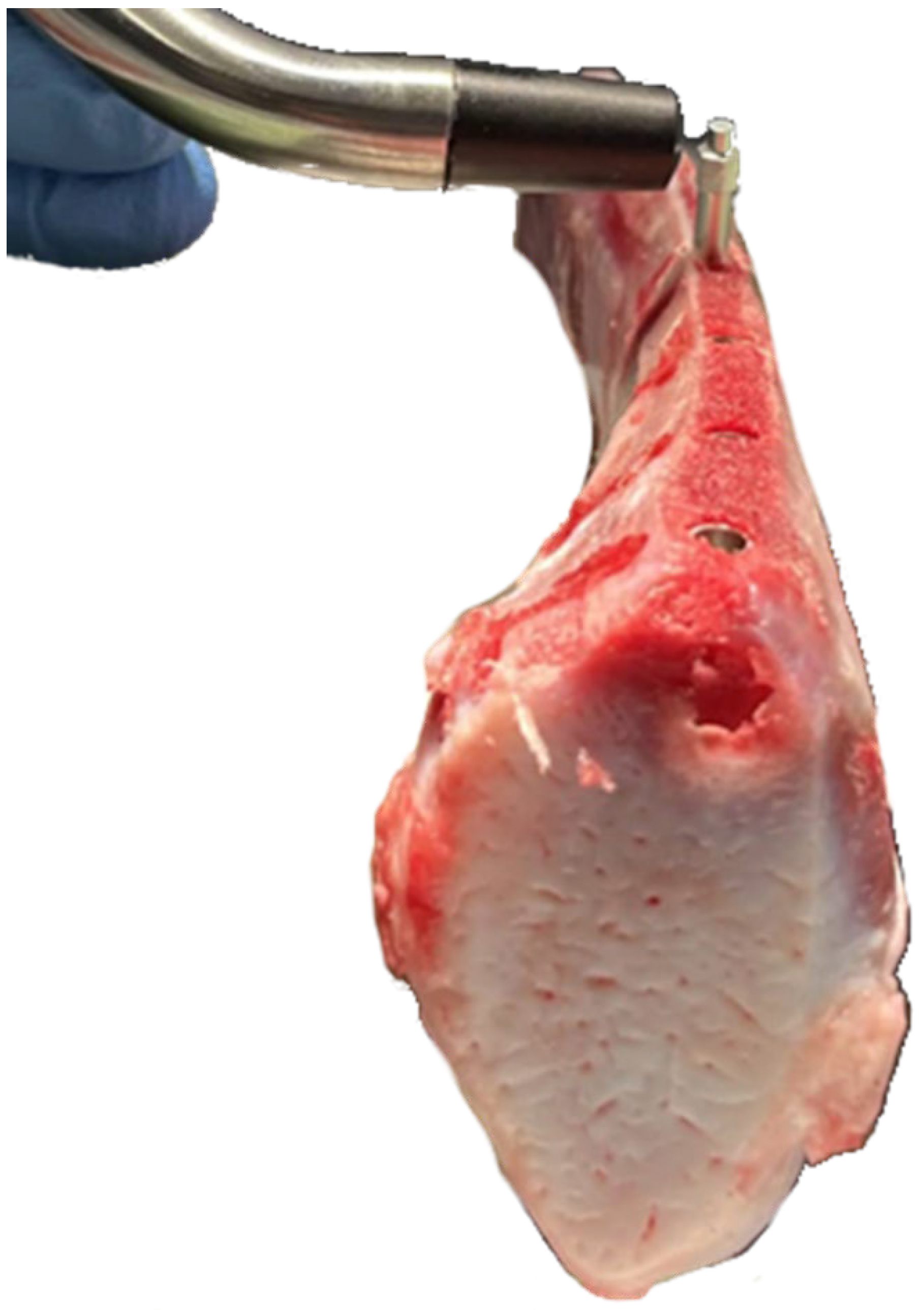 Materials 18 00700 g005