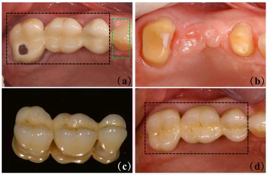 Materials 18 00804 g004