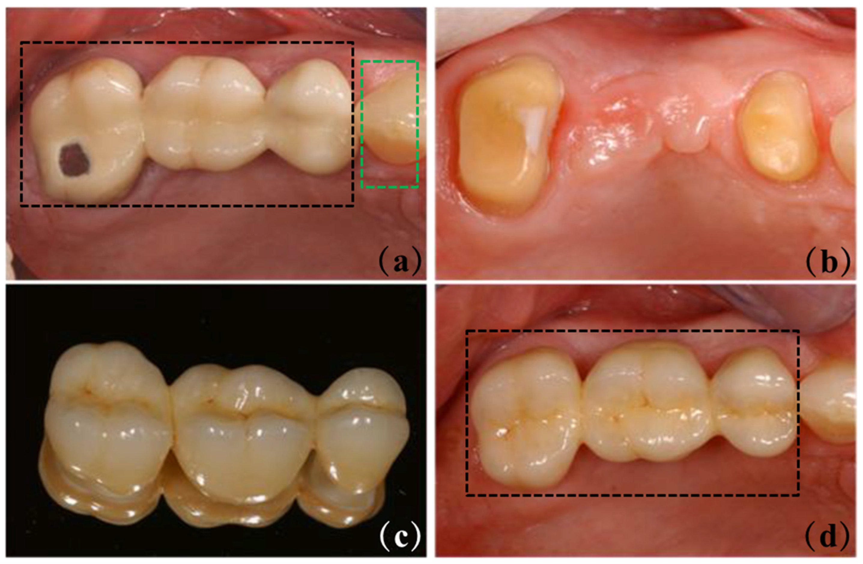 Materials 18 00804 g004
