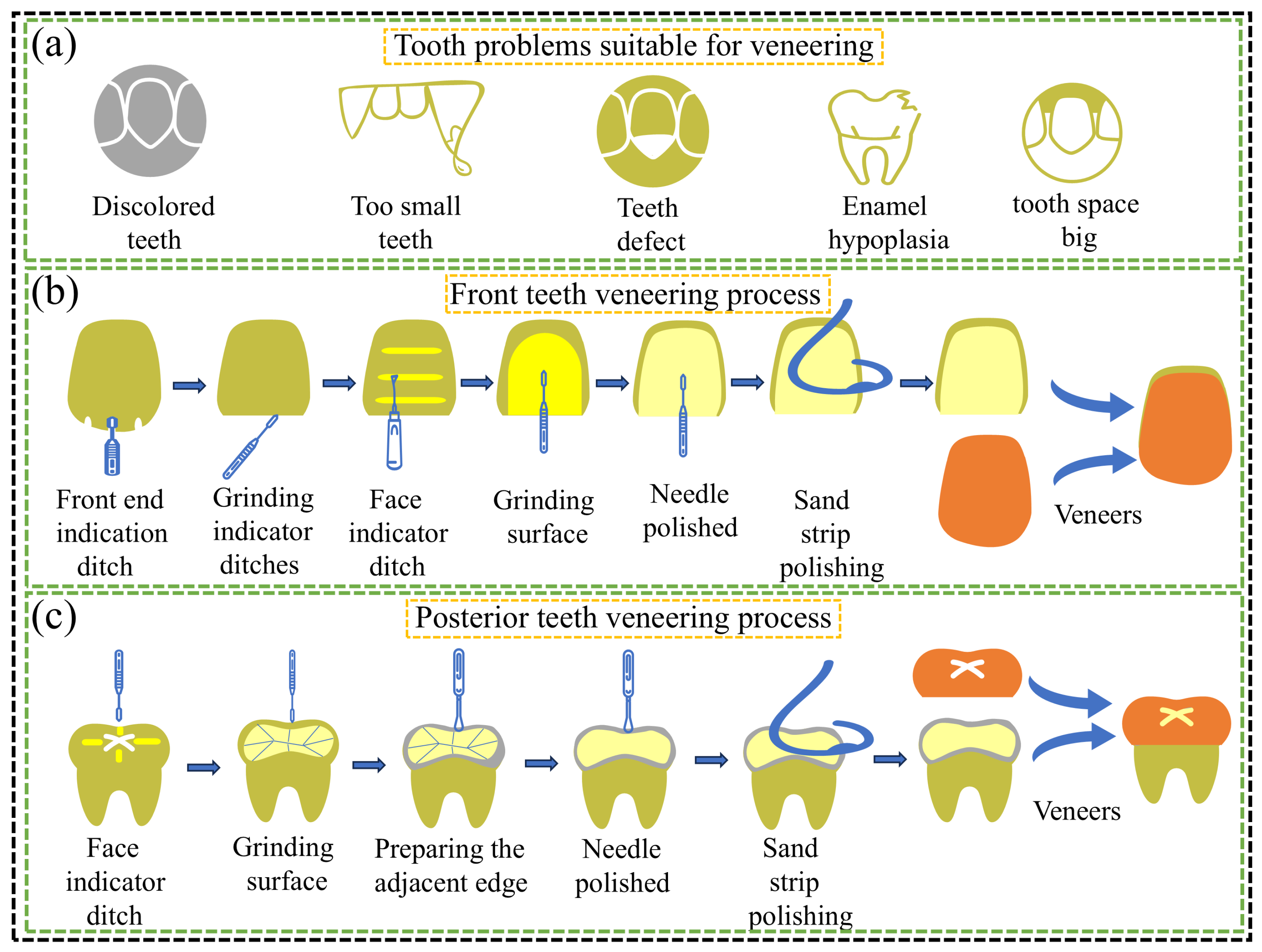 Materials 18 00804 g008
