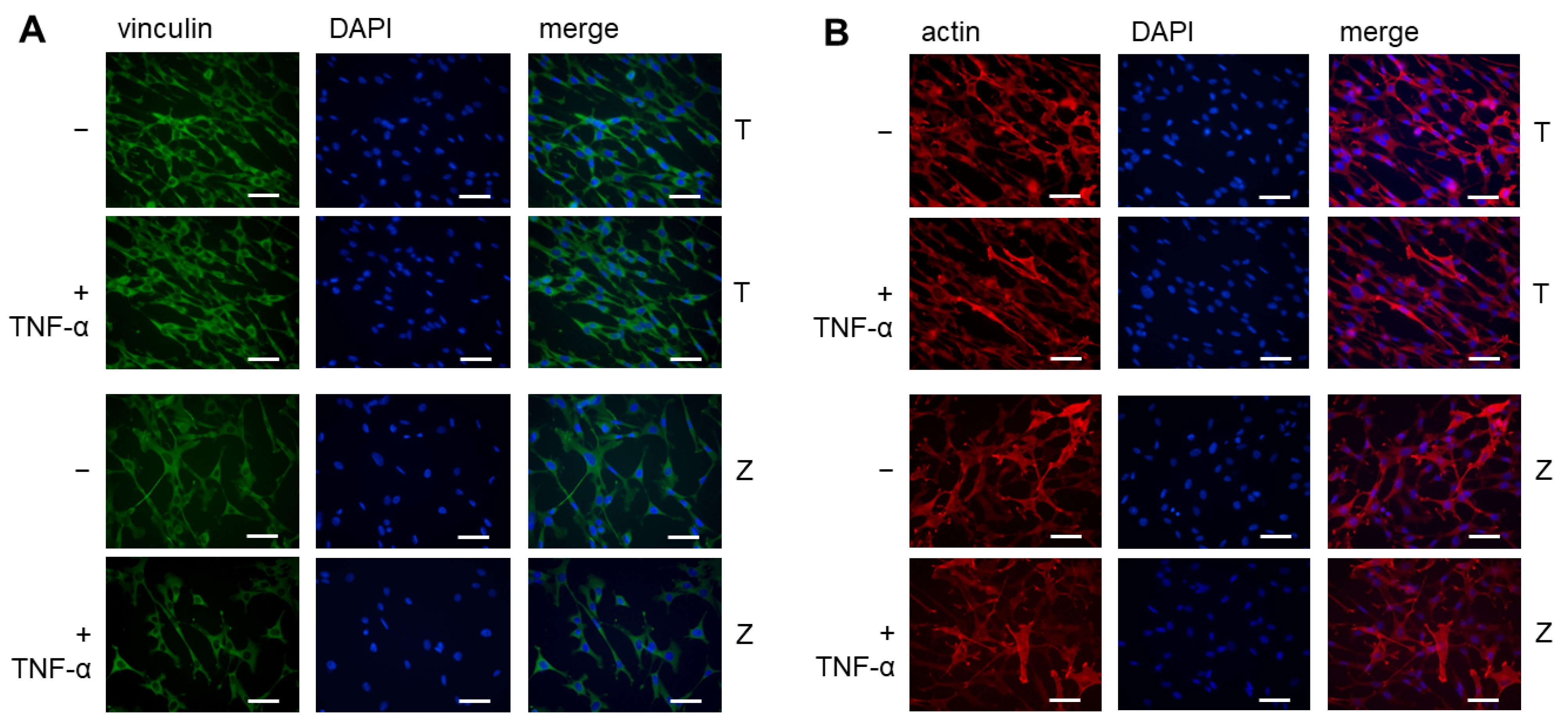 Materials 18 00884 g002