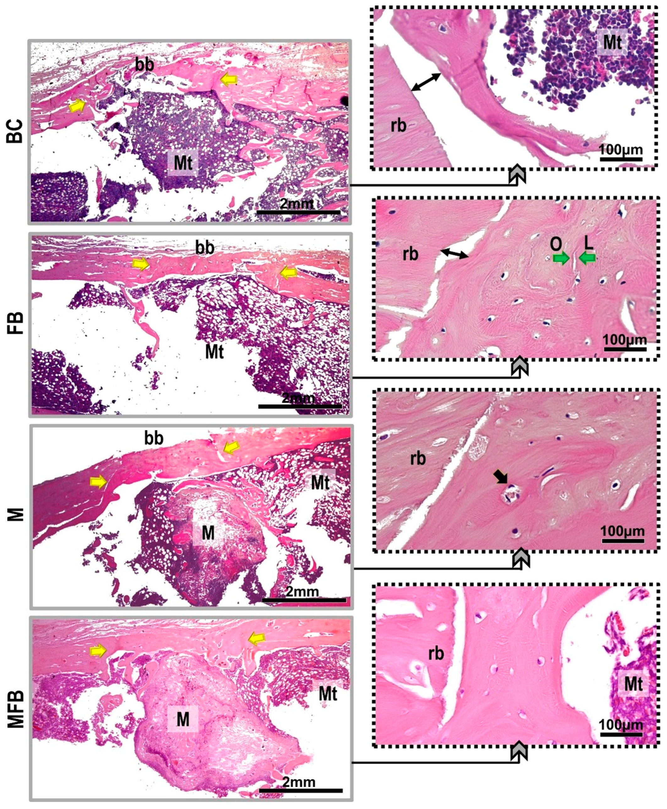 Materials 18 01704 g006