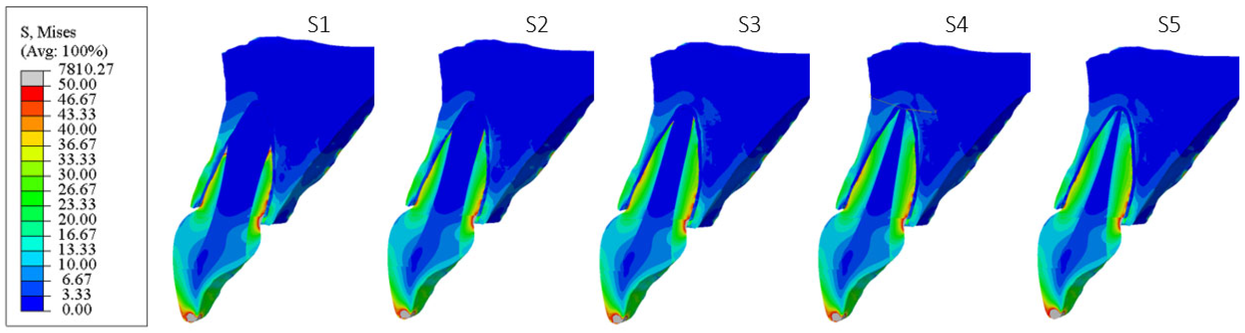 Materials 18 02305 g010