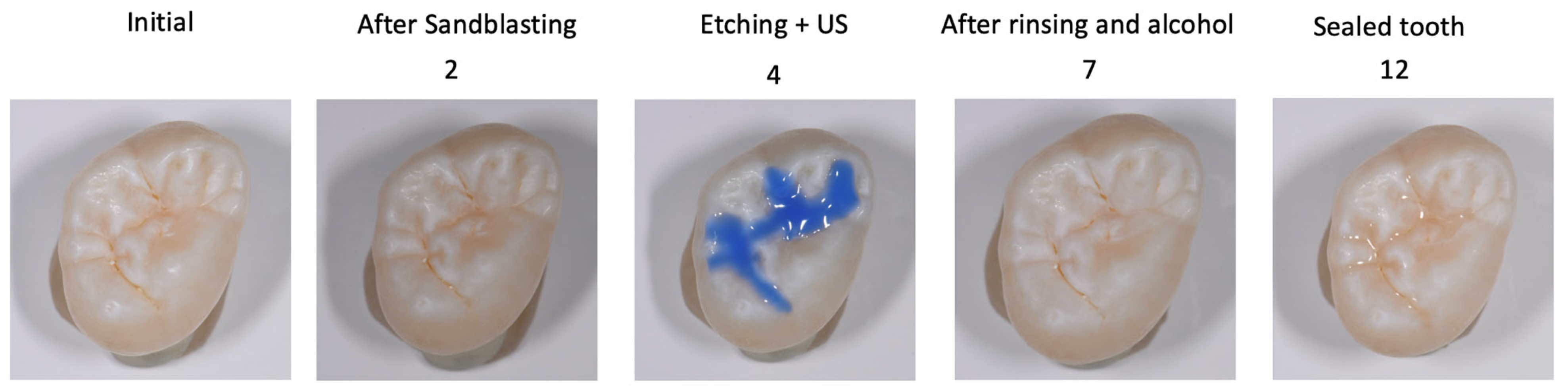 Materials 18 02421 g002