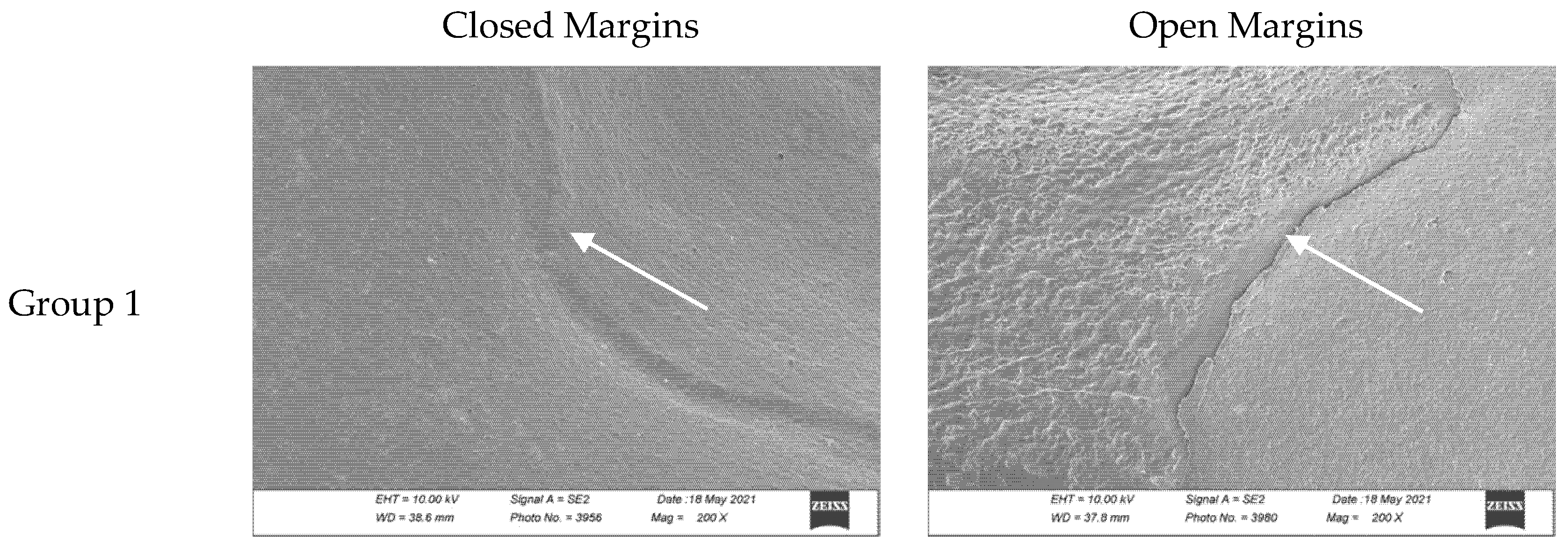 Materials 18 02421 g003a