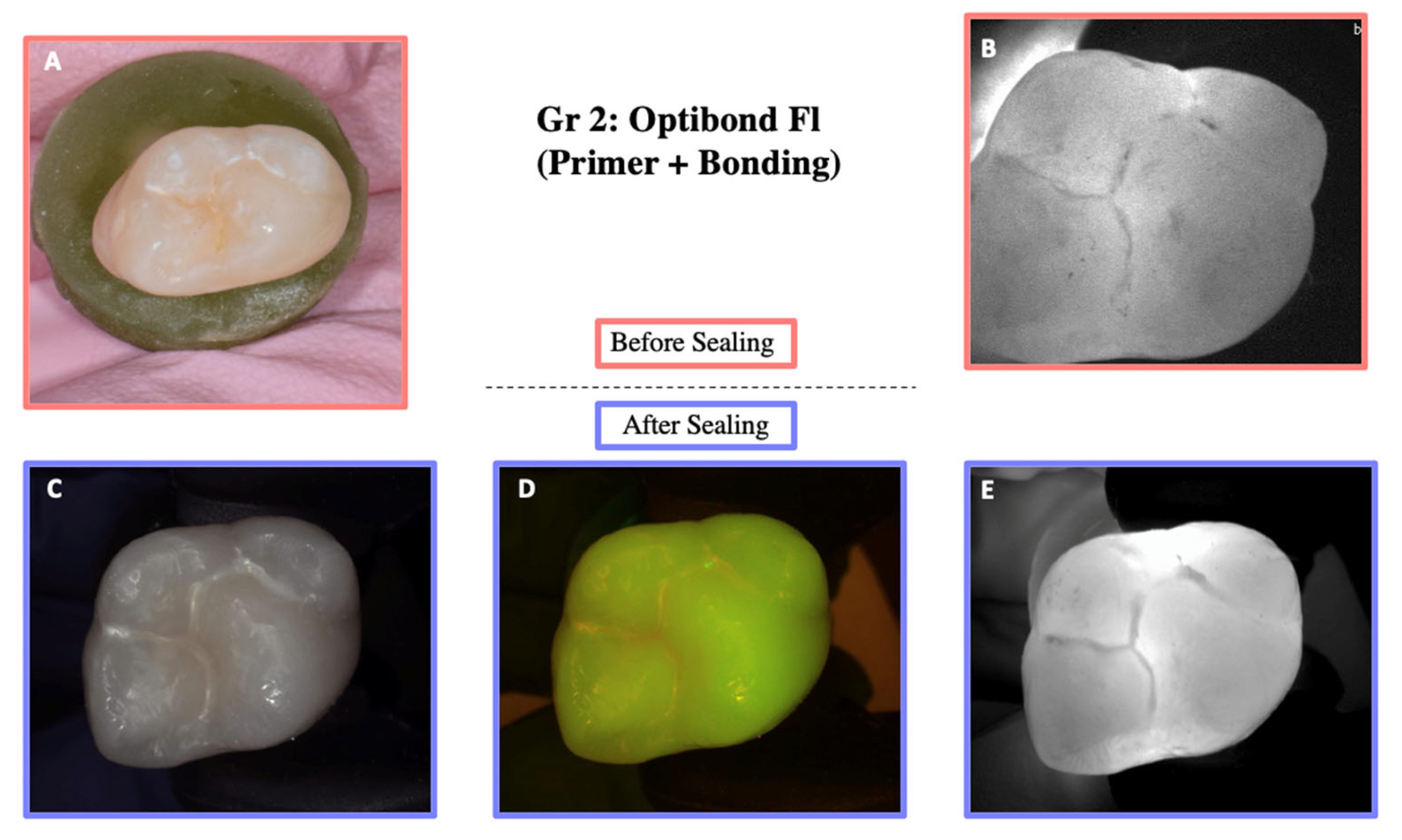 Materials 18 02421 g006