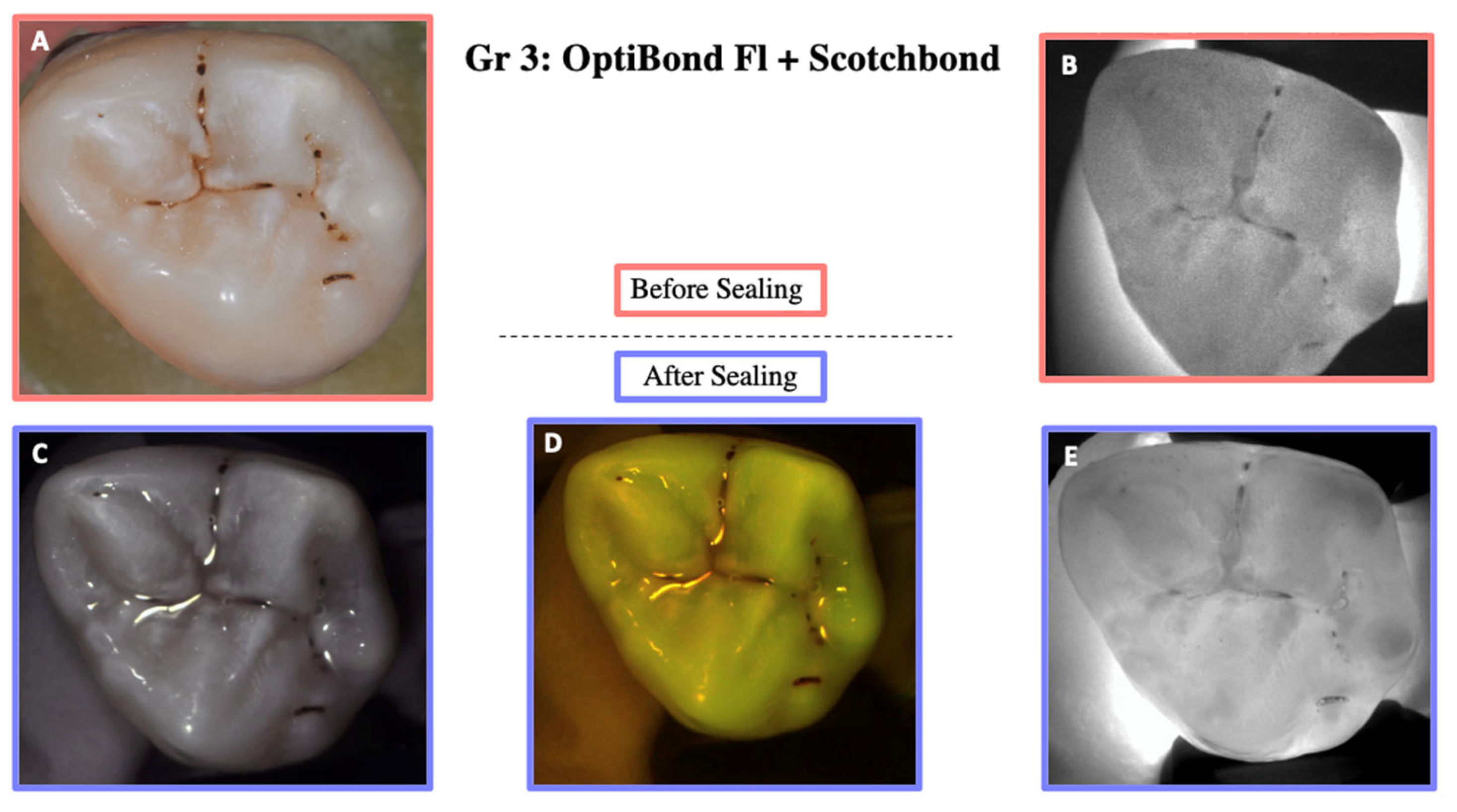 Materials 18 02421 g007