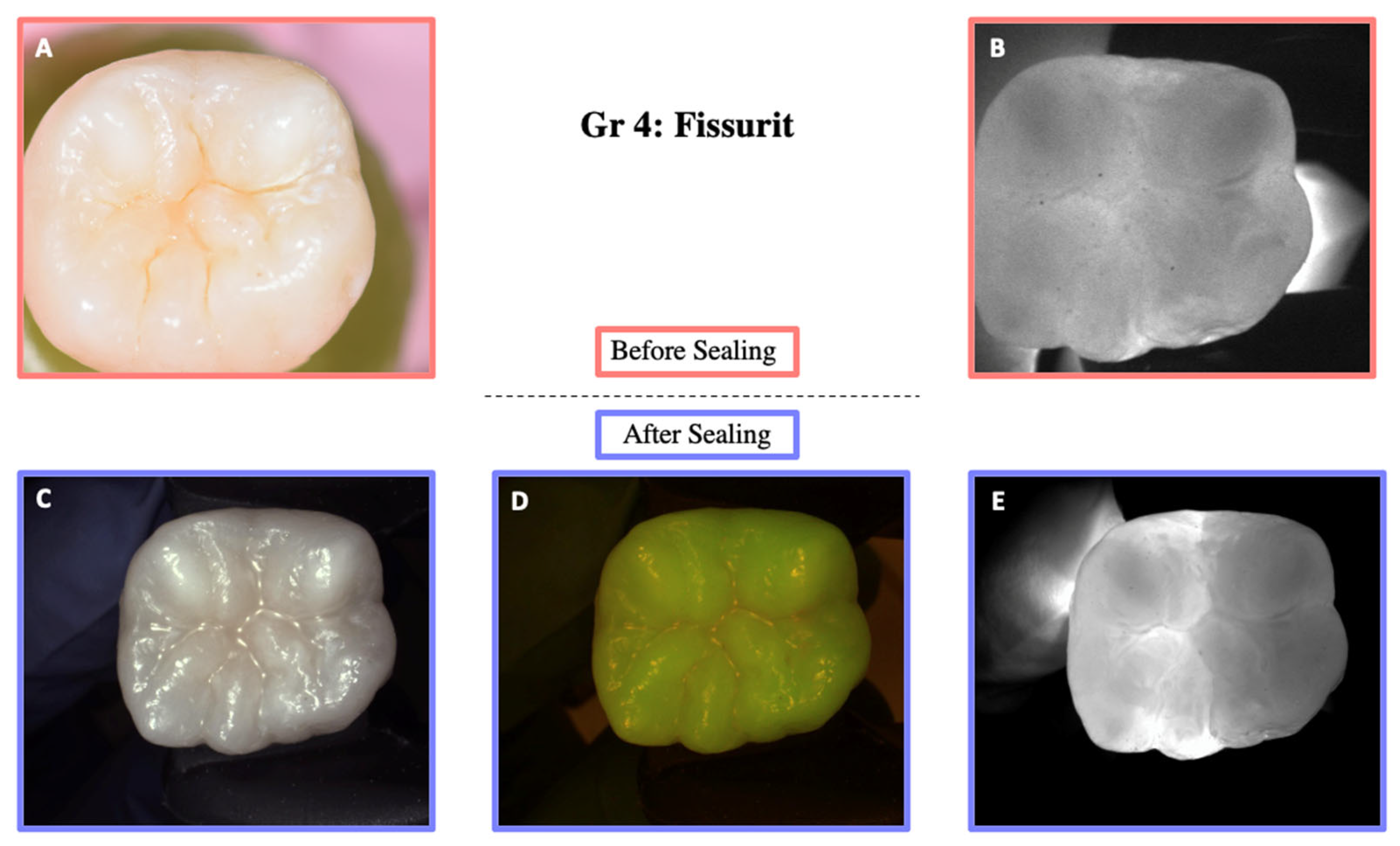 Materials 18 02421 g008
