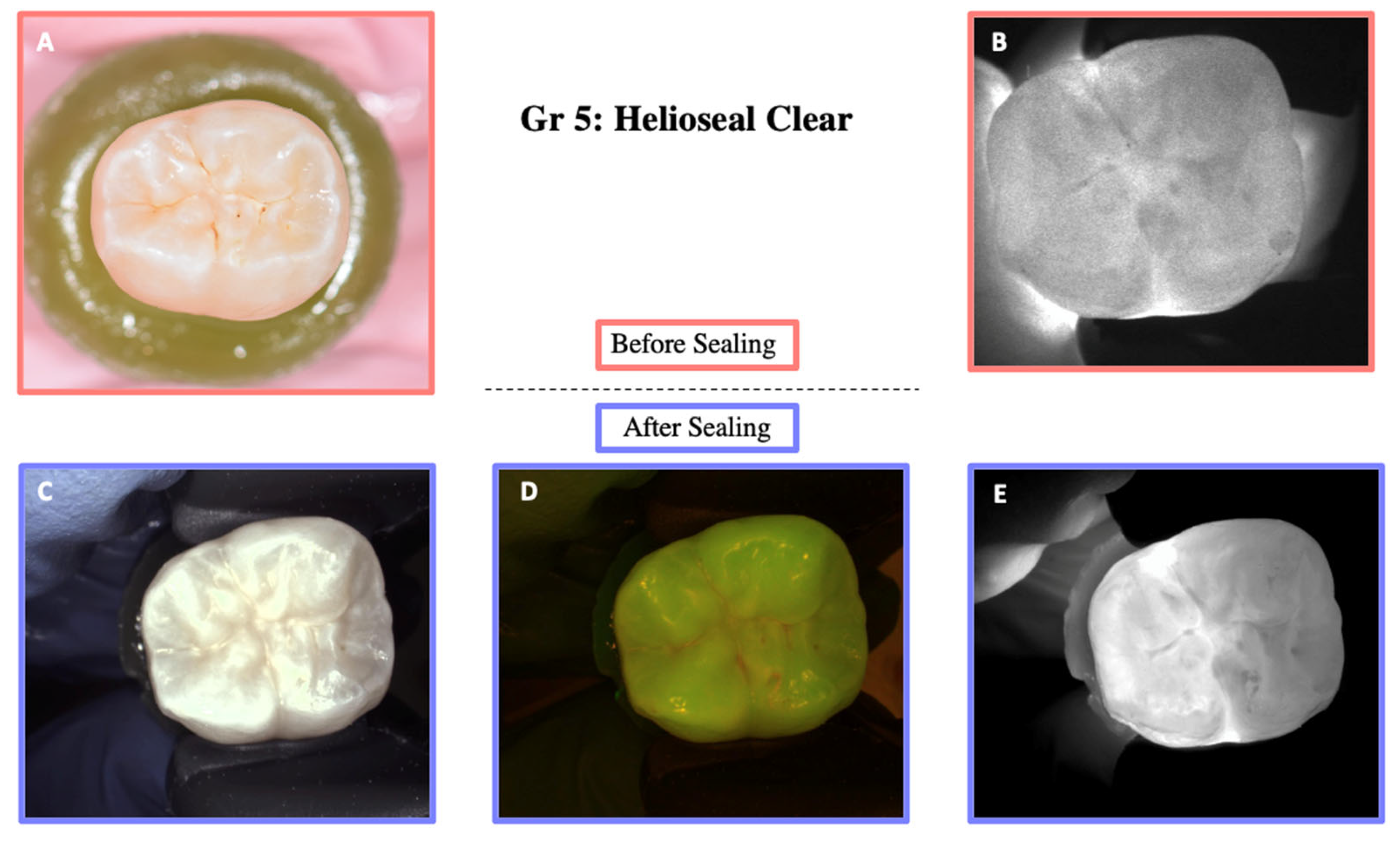 Materials 18 02421 g009