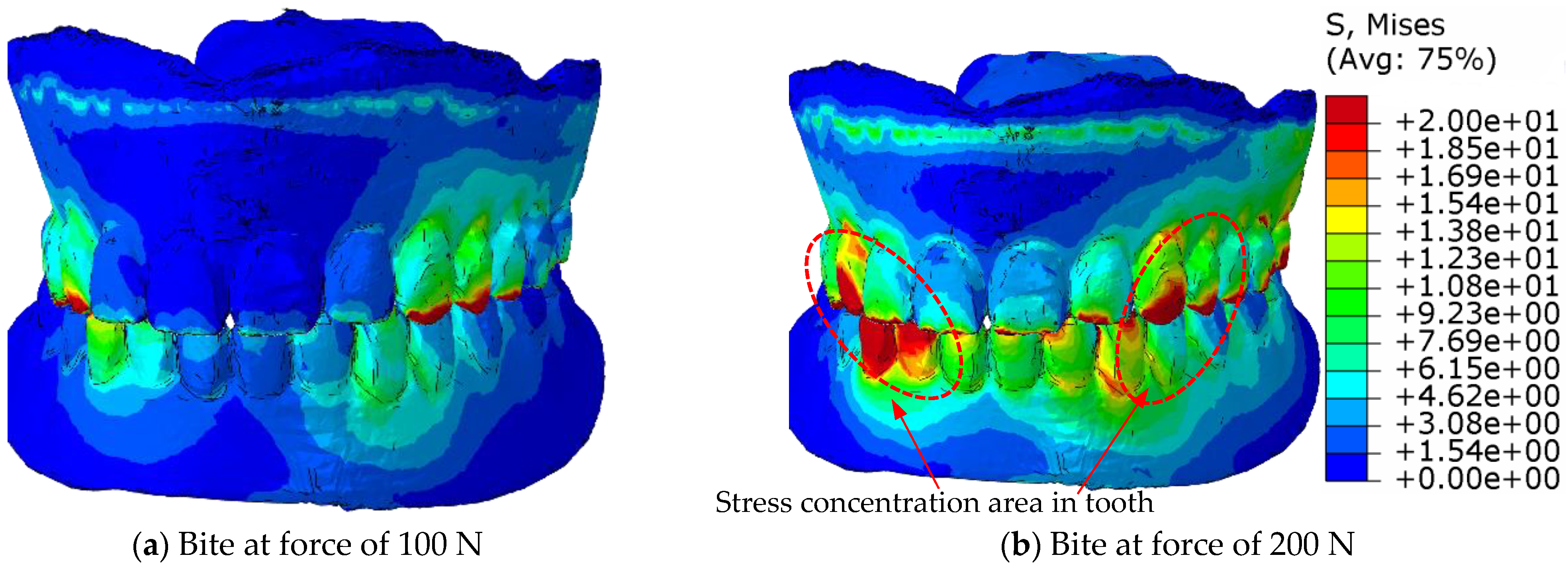 Materials 18 02427 g012