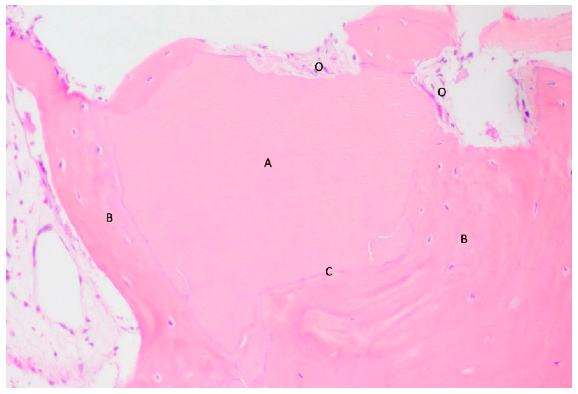 Materials 18 02518 g005