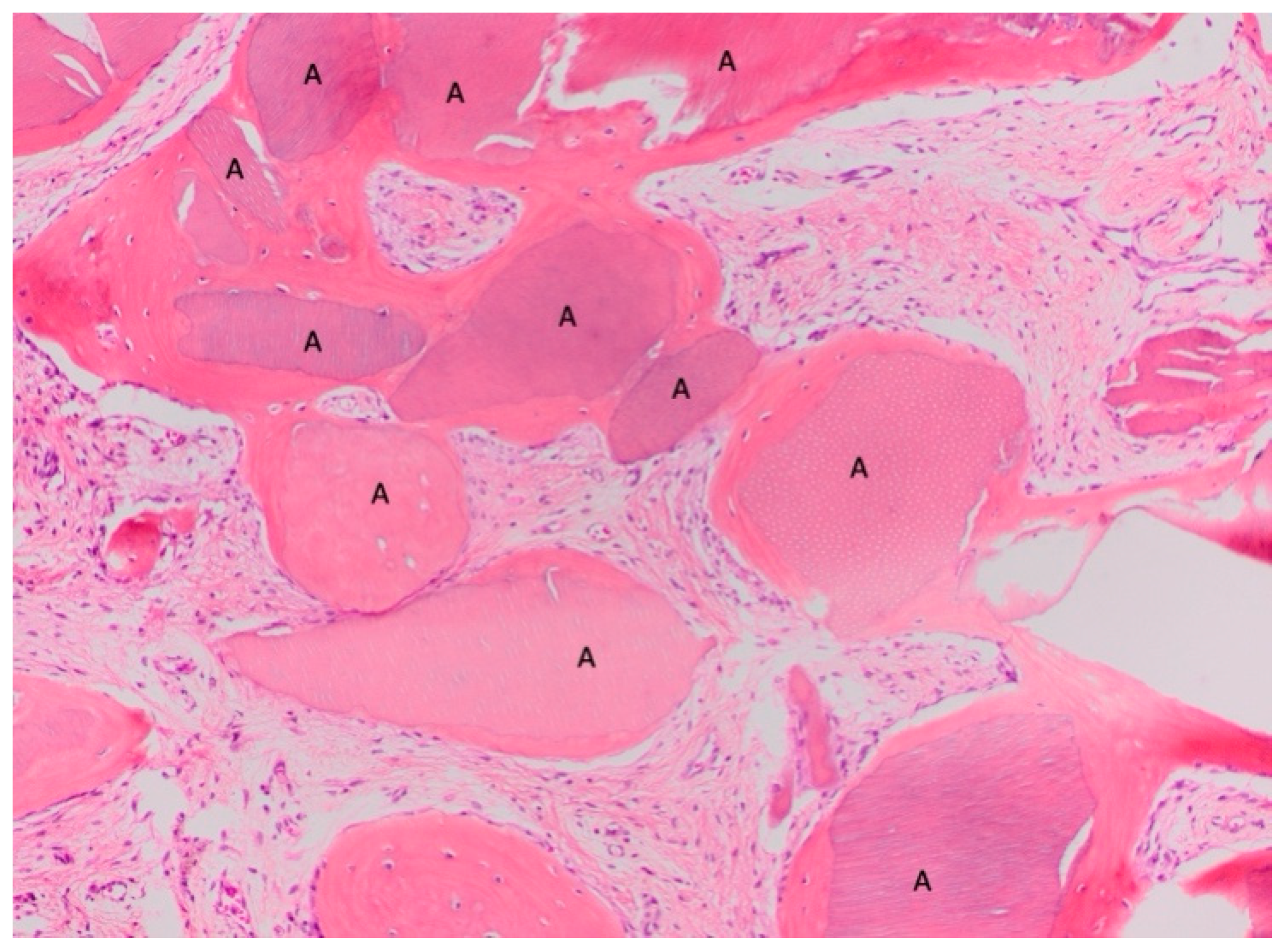 Materials 18 02518 g006