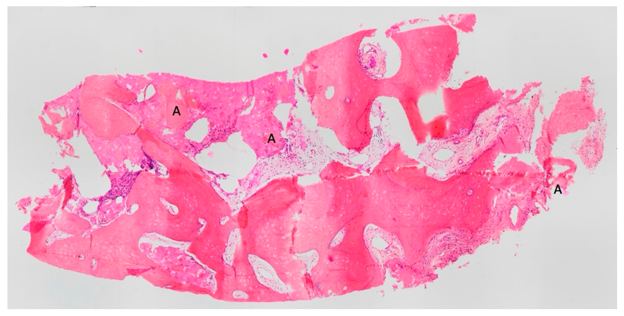 Materials 18 02518 g009