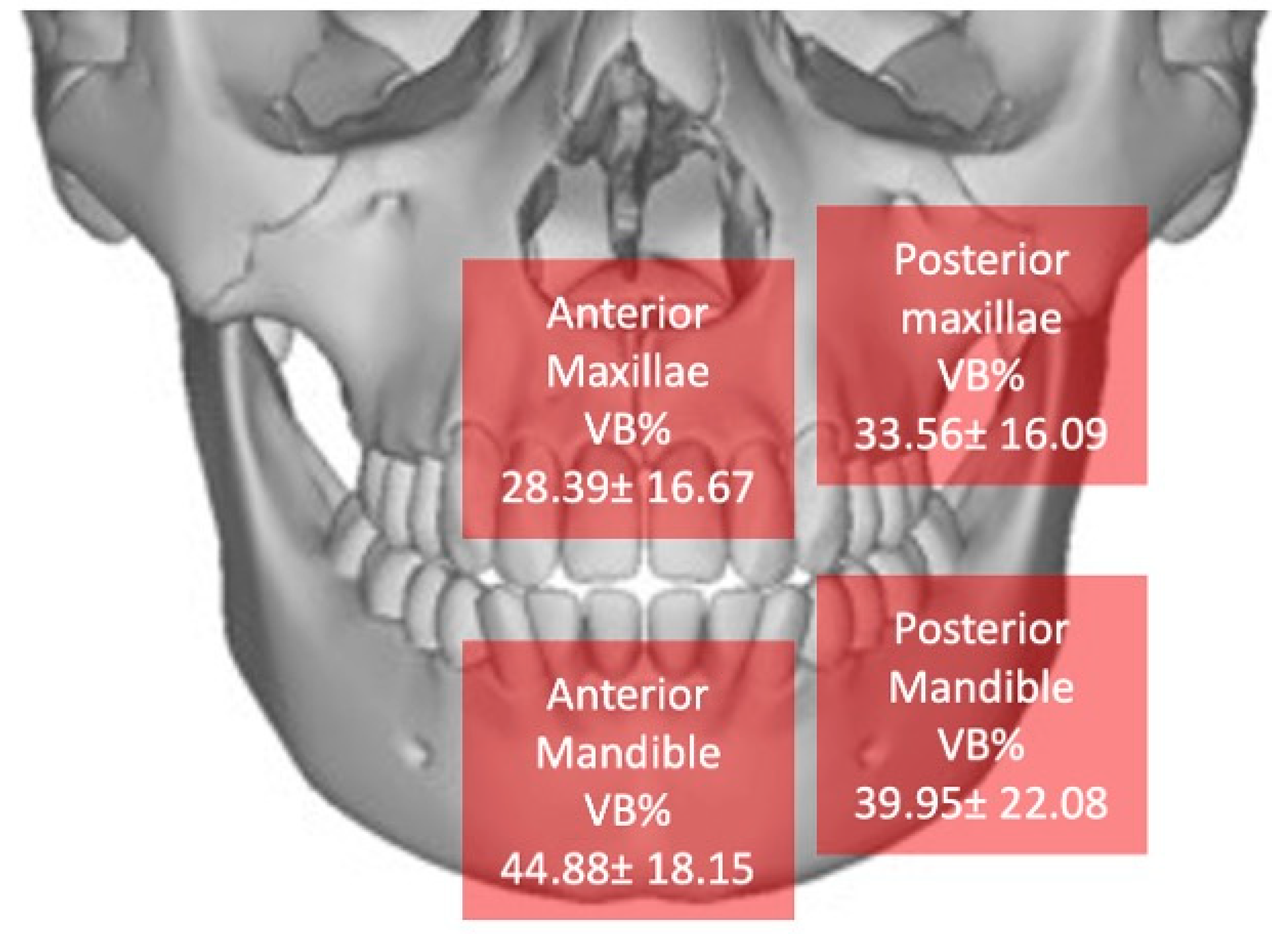 Materials 18 02518 g010