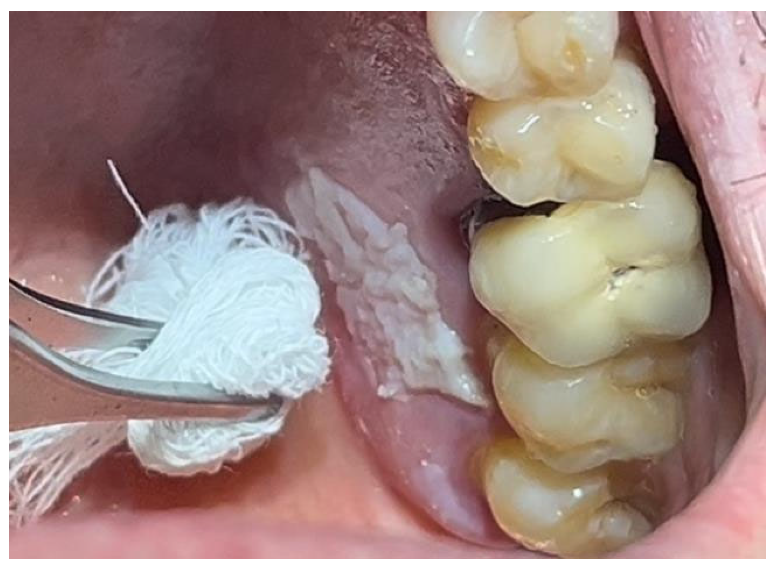 Materials 18 02642 g002